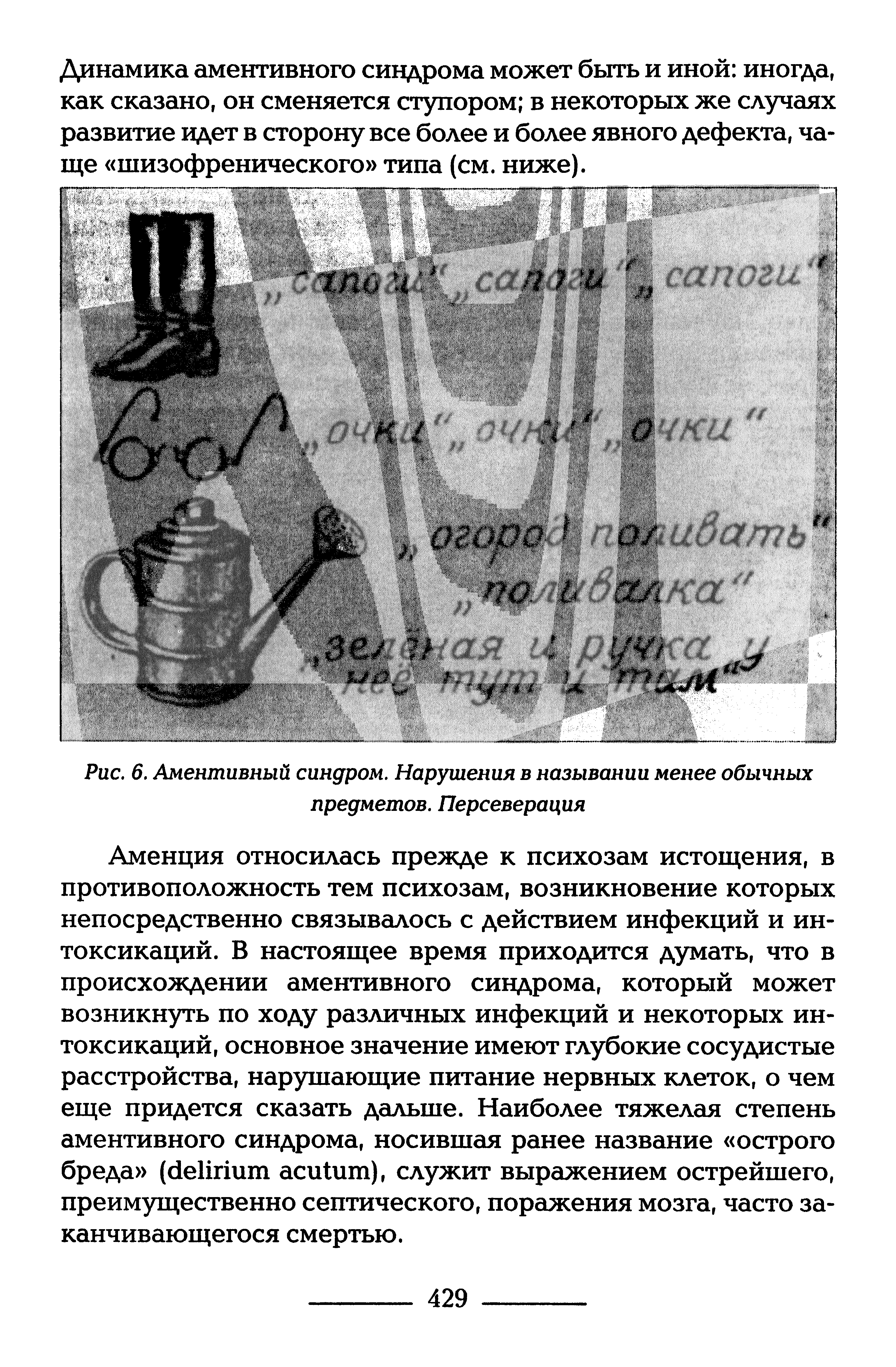 Рис. 6. Аментивный синдром. Нарушения в назывании менее обычных предметов. Персеверация...