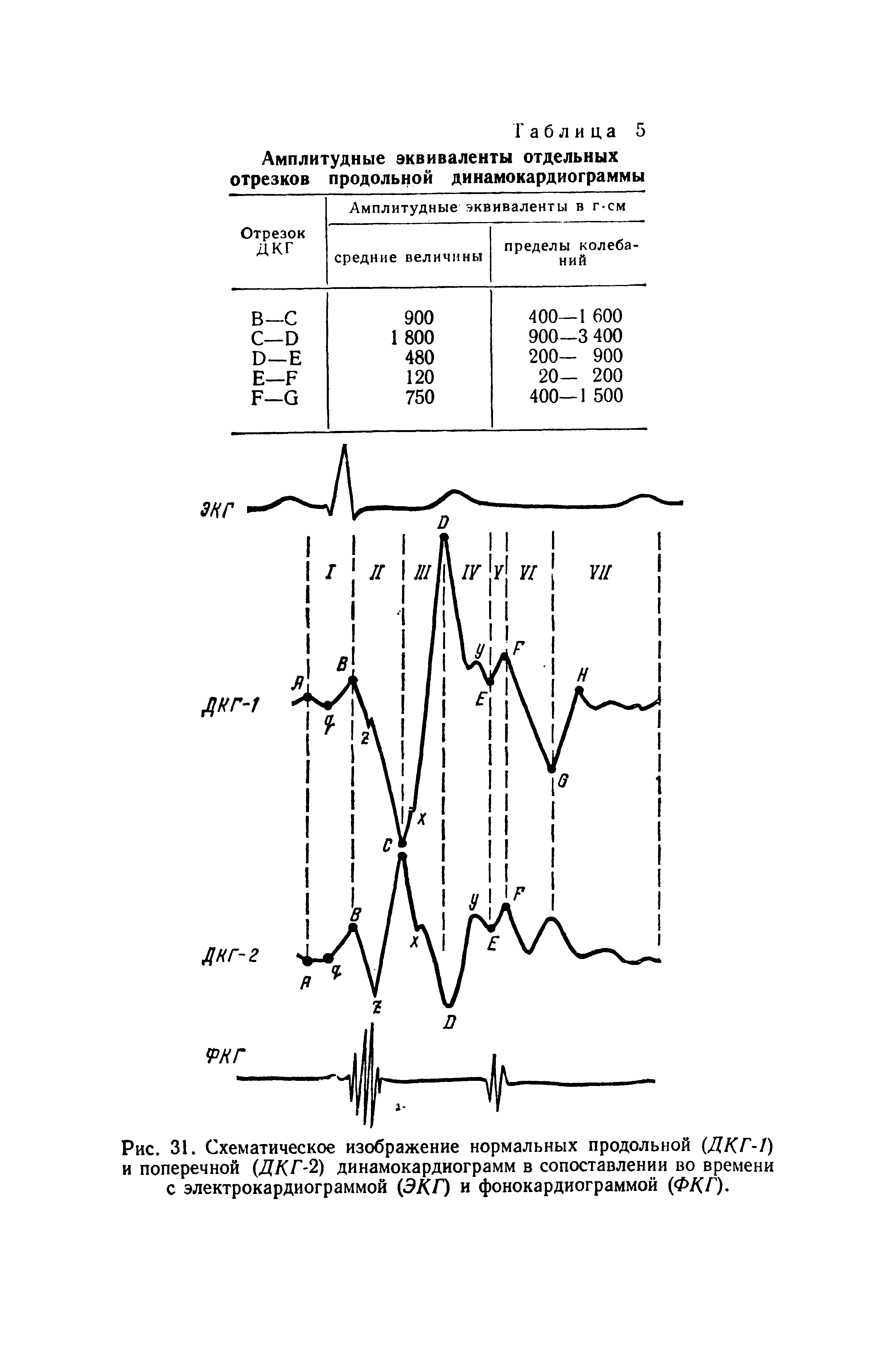 Рис. 31. Схематическое изображение нормальных продольной (ДКГ-1) и поперечной (ДЛЛ2) динамокардиограмм в сопоставлении во времени с электрокардиограммой (ЭКГ) и фонокардиограммой (ФКГ).
