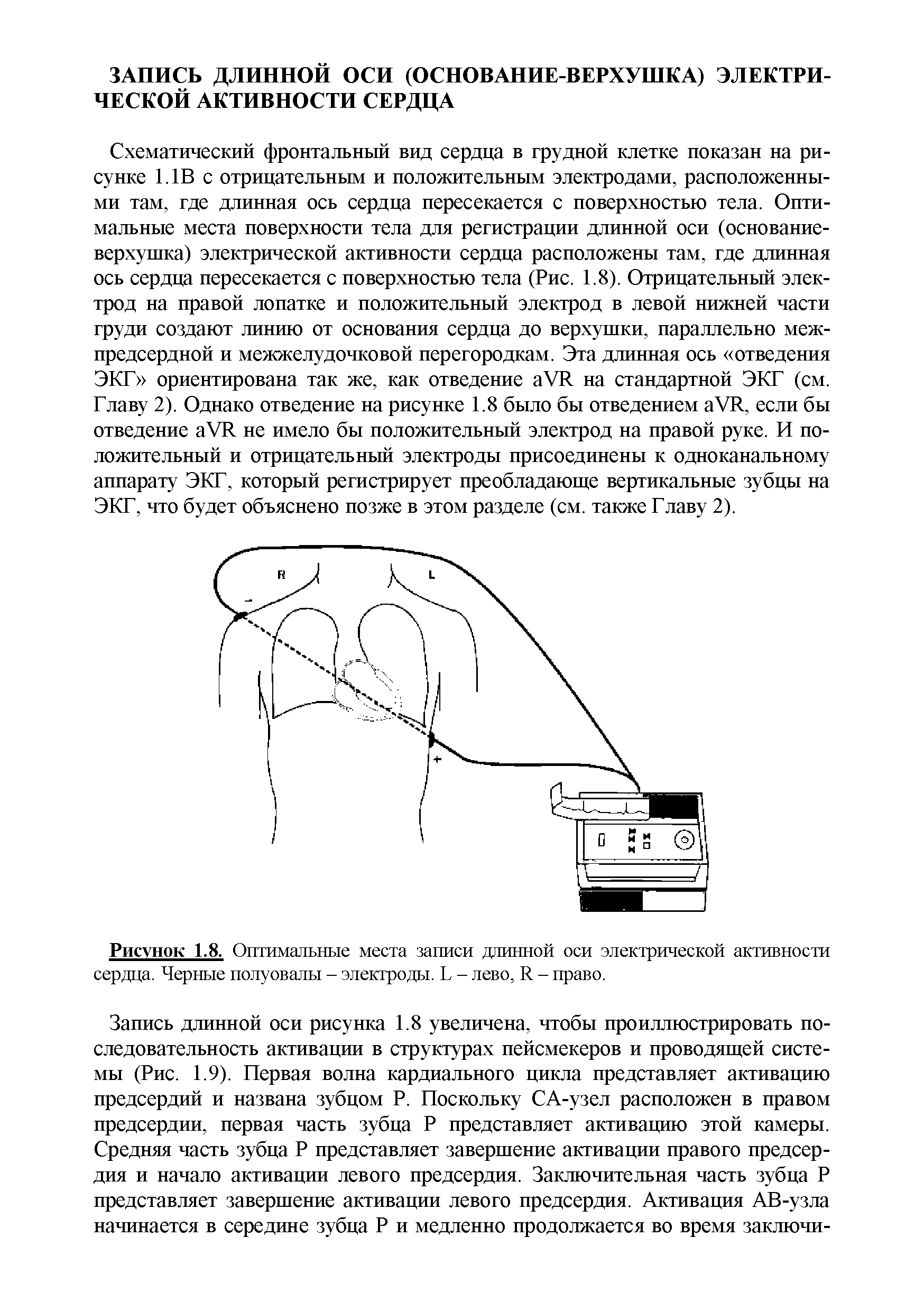 Рисунок 1.8. Оптимальные места записи длинной оси электрической активности сердца. Черные полуовалы - электроды. Ь - лево, Л - право.