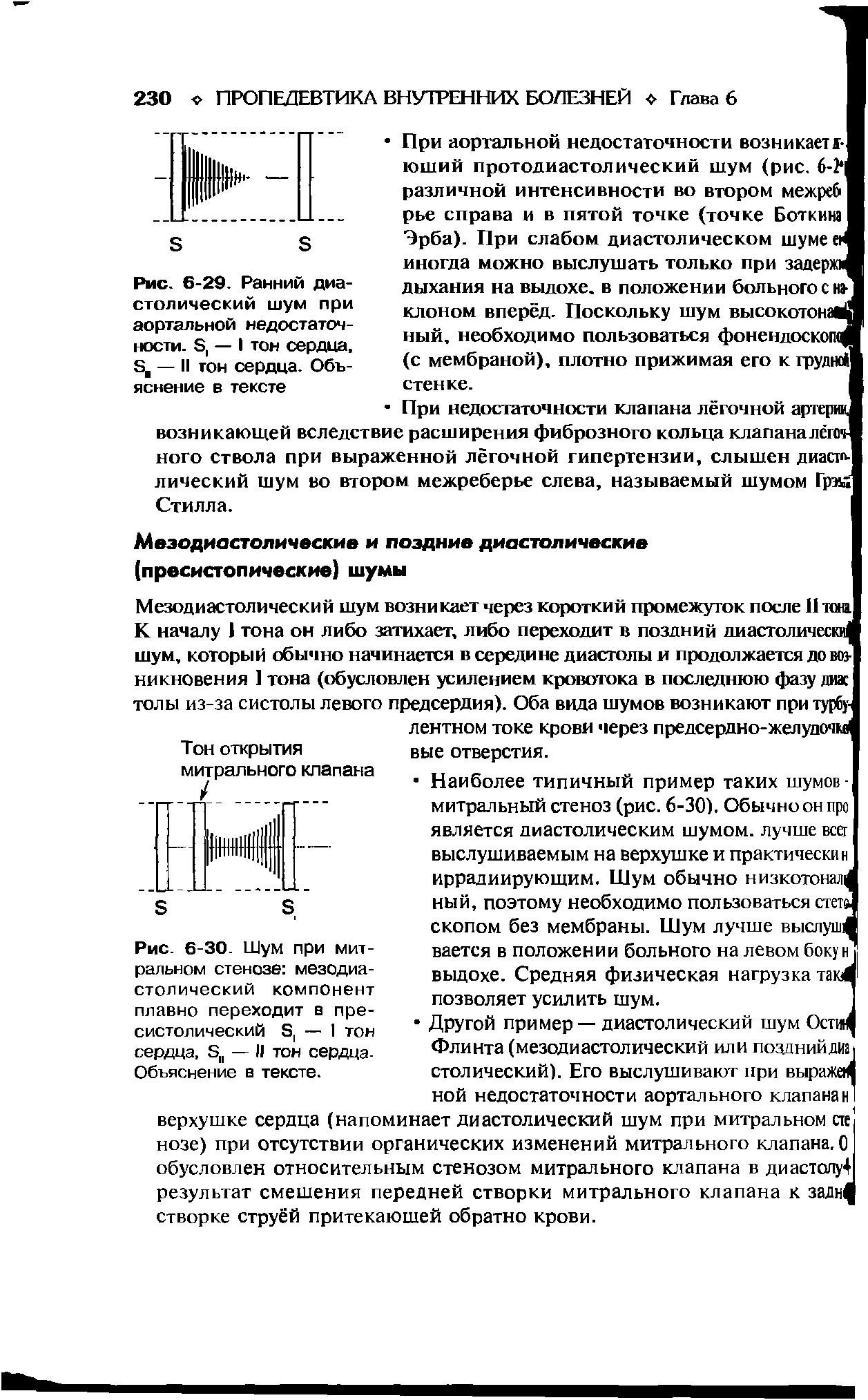 Рис. 6-30. Шум при митральном стенозе мезодиастол ический компонент плавно переходит в пре-систолический Э, — 1 тон сердца, Бц — II тон сердца-Объяснение в тексте.