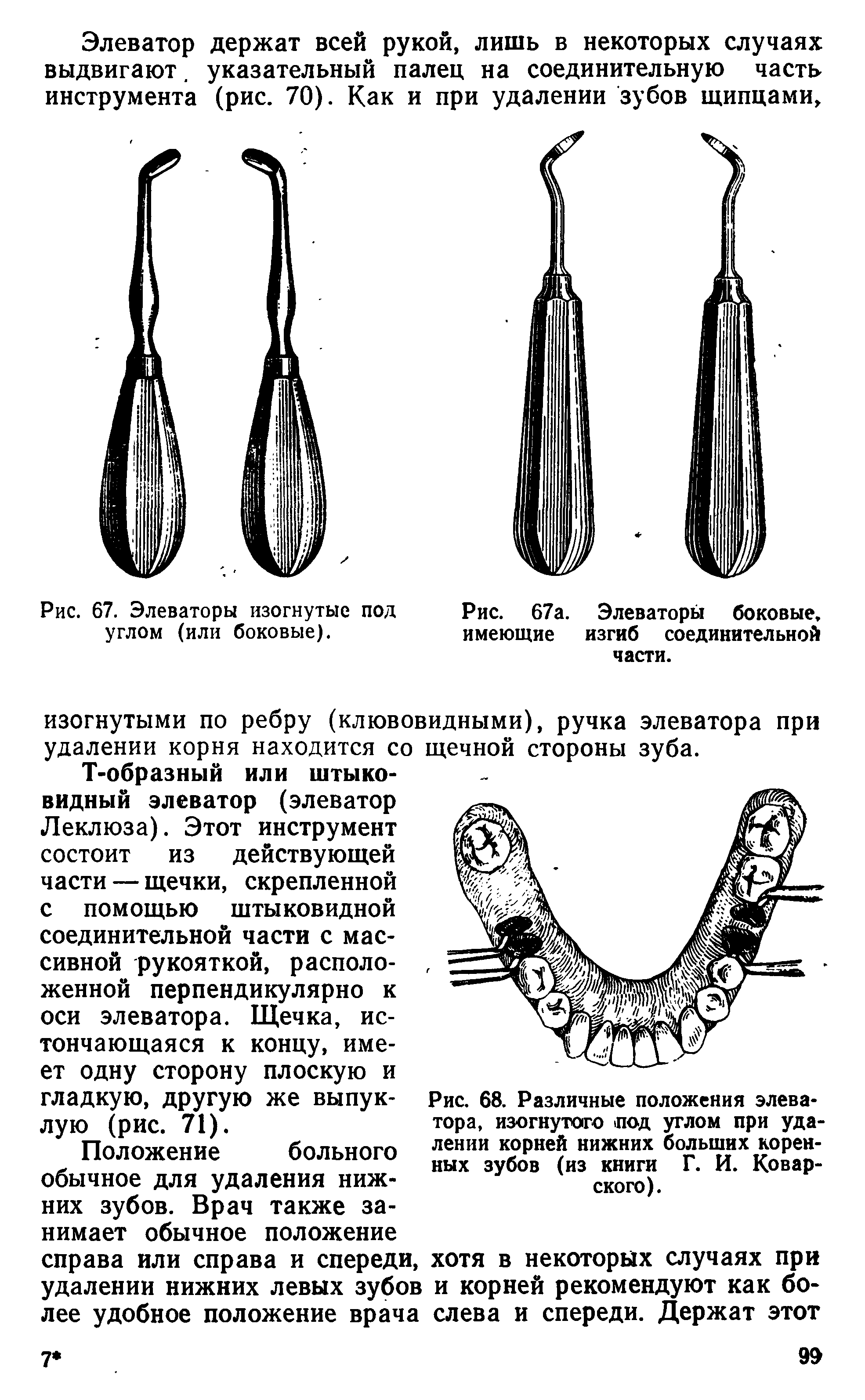 Рис. 68. Различные положения элеватора, изогнутого под углом при удалении корней нижних больших коренных зубов (из книги Г. И. Ковар-ского).