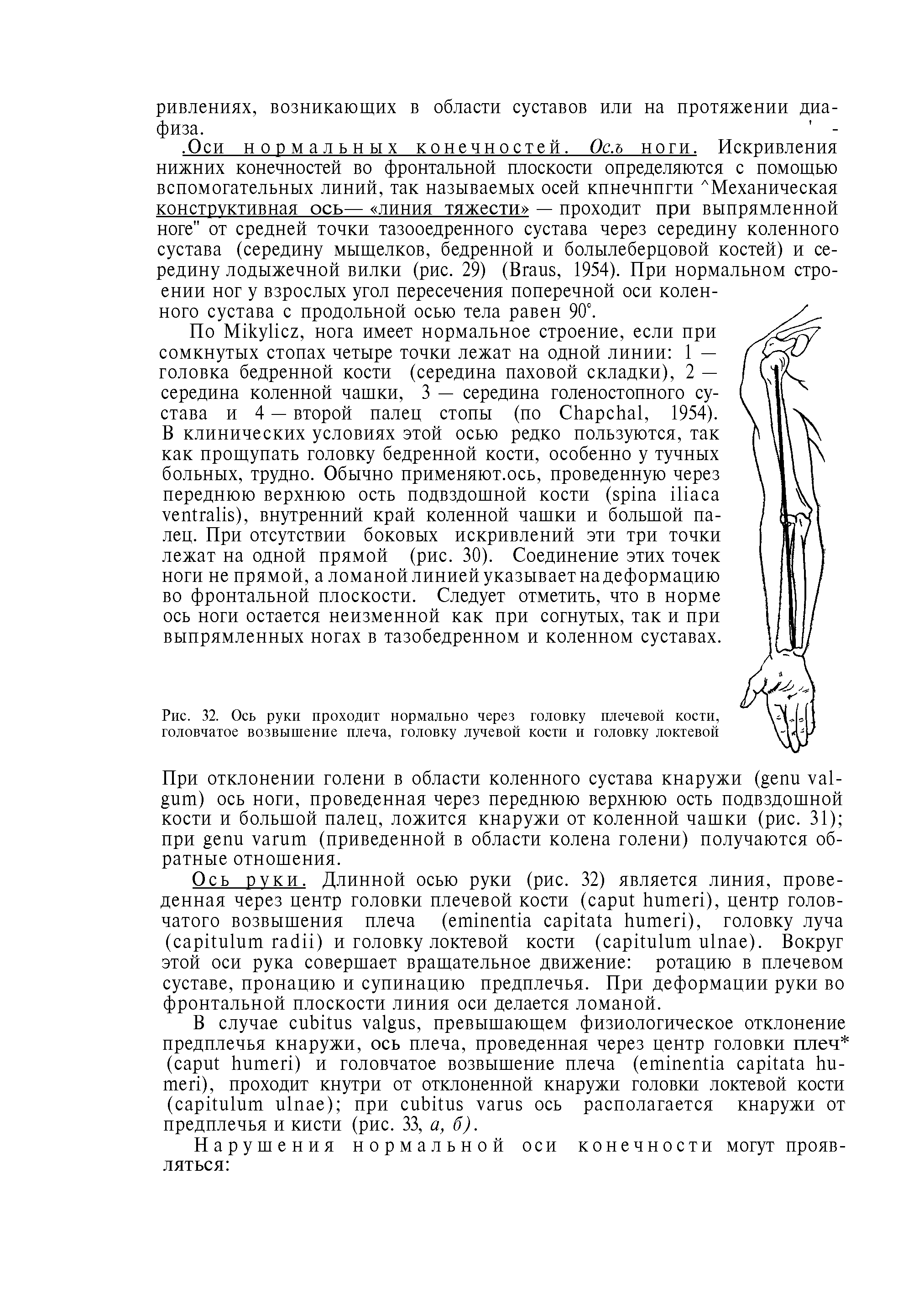 Рис. 32. Ось руки проходит нормально через головку плечевой кости, головчатое возвышение плеча, головку лучевой кости и головку локтевой...