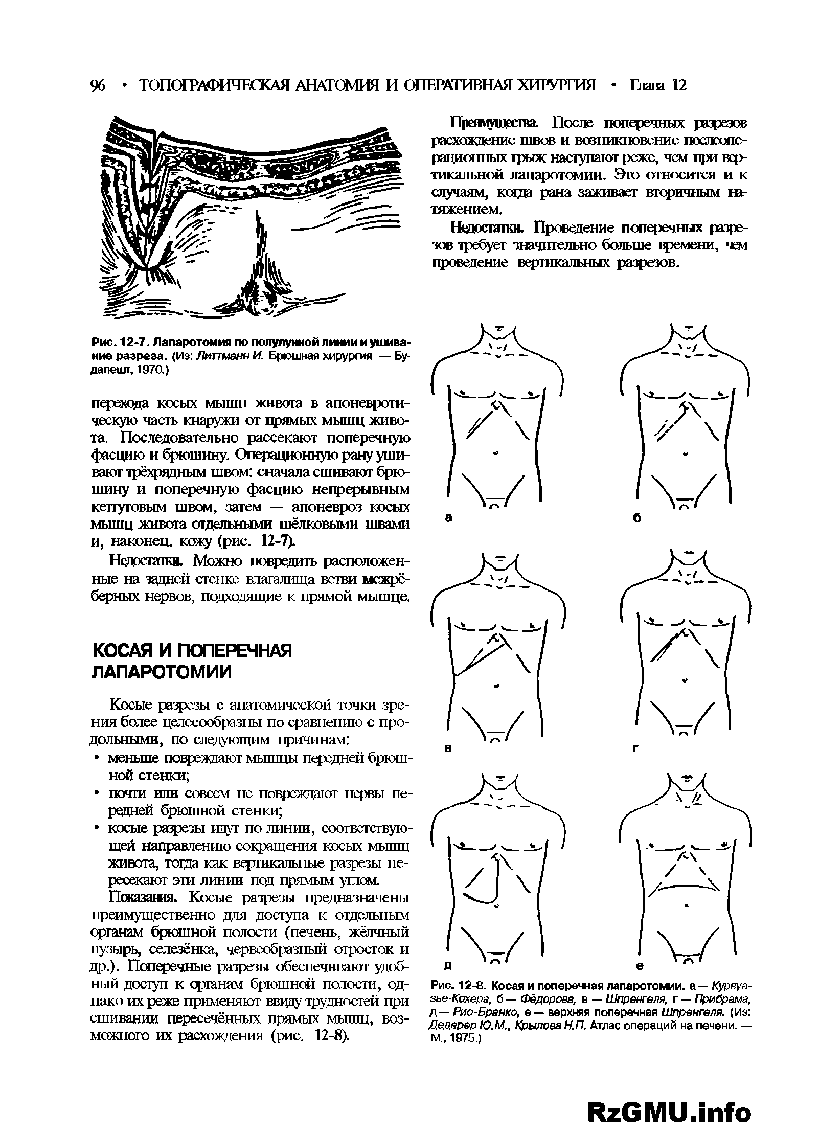 Рис. 12-8. Косая и поперечная лапаротомии, а — Курвуа-зье-Кохера, б — Фёдорова, в — Шпренгеля, г — Прибрала, д— Рис-Бранко, е— верхняя поперечная Шпренгеля. (из Дедерер Ю.М., Крылова Н.П. Атлас операций на печени. — м., 1975.)...