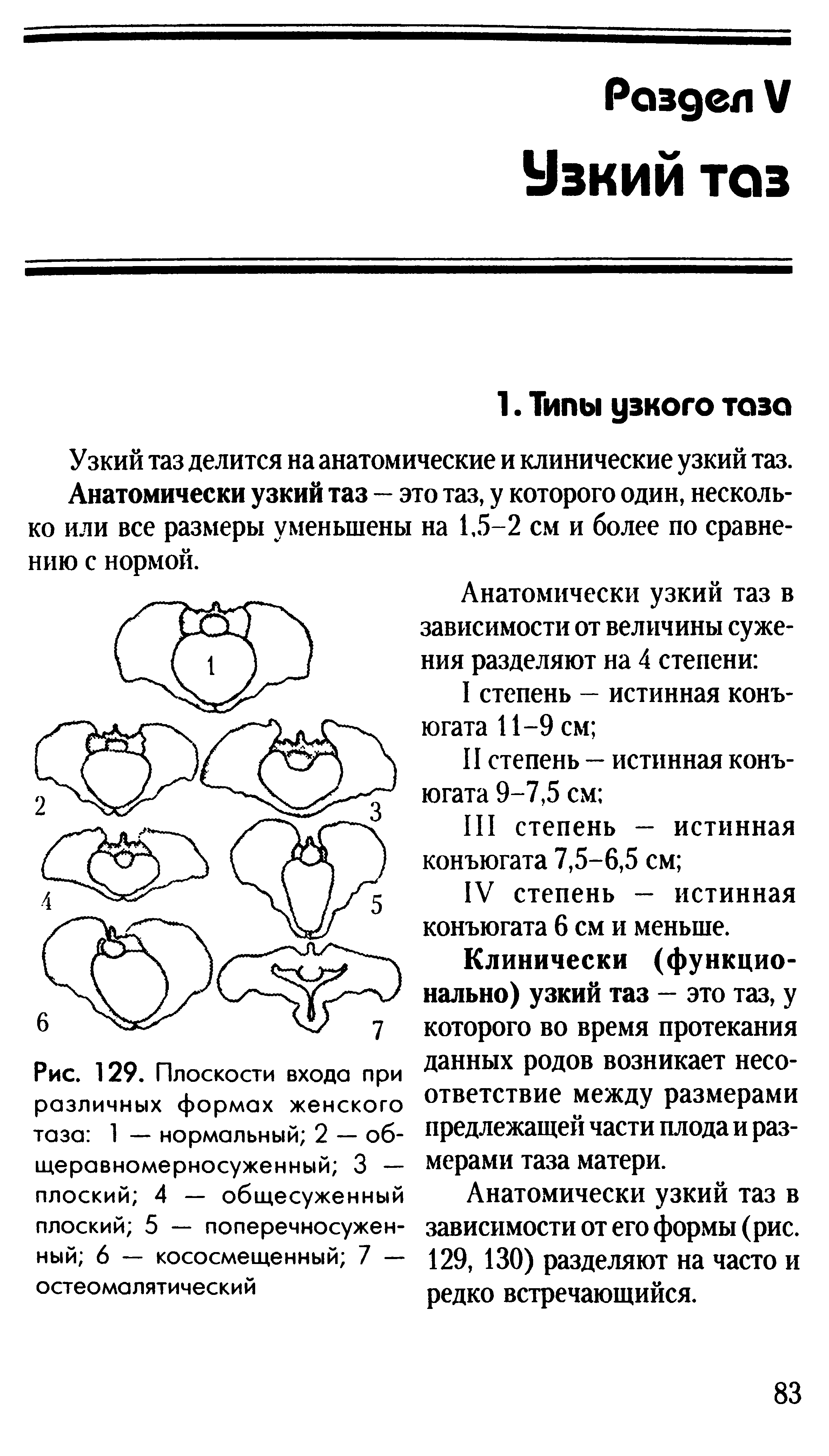 Рис. 129. Плоскости входа при различных формах женского таза 1 — нормальный 2 — об-щеравномерносуженный 3 — плоский 4 — общесуженный плоский 5 — поперечносужен-ный 6 — кососмещенный 7 — остеомалятический...