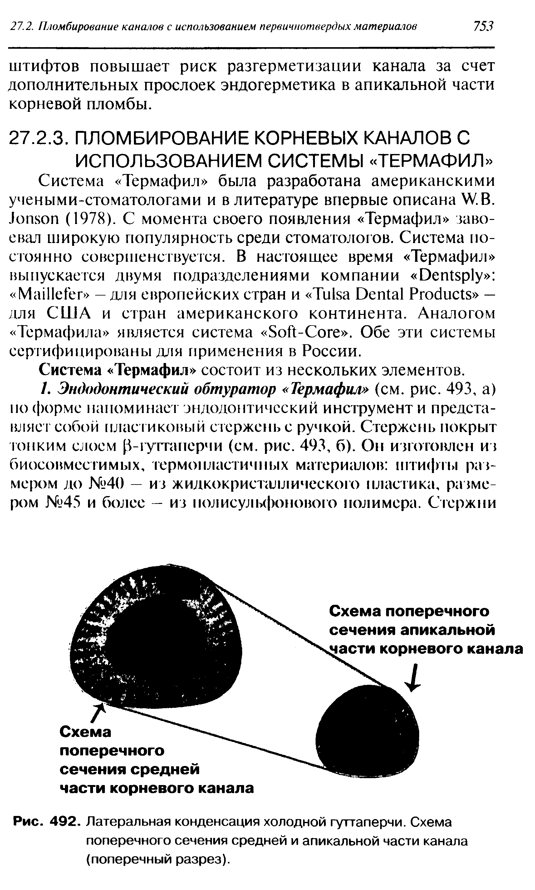 Рис. 492. Латеральная конденсация холодной гуттаперчи. Схема поперечного сечения средней и апикальной части канала (поперечный разрез).