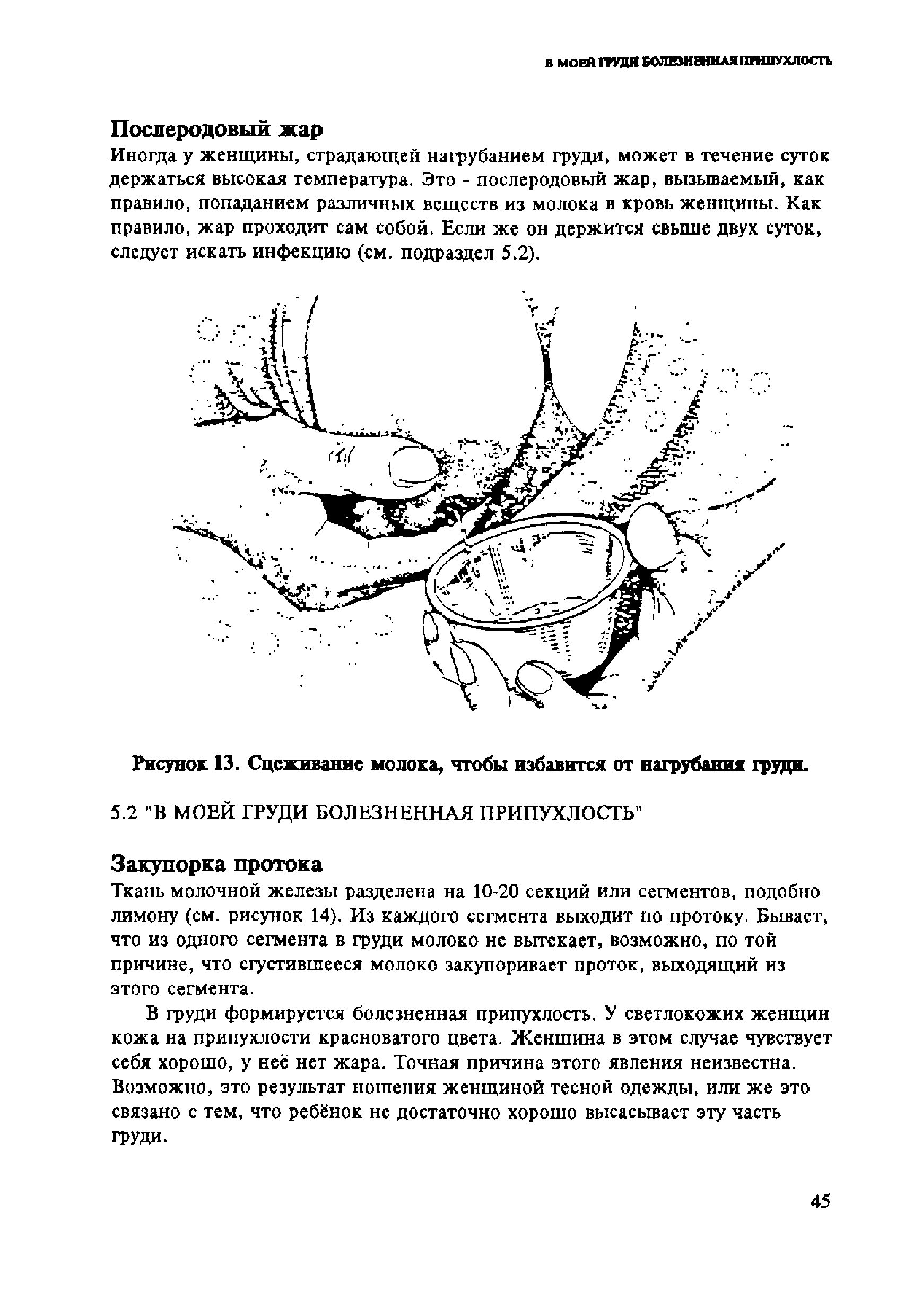 Рисунок 13. Сцеживание молока, чтобы избавится от нагрубания груди.