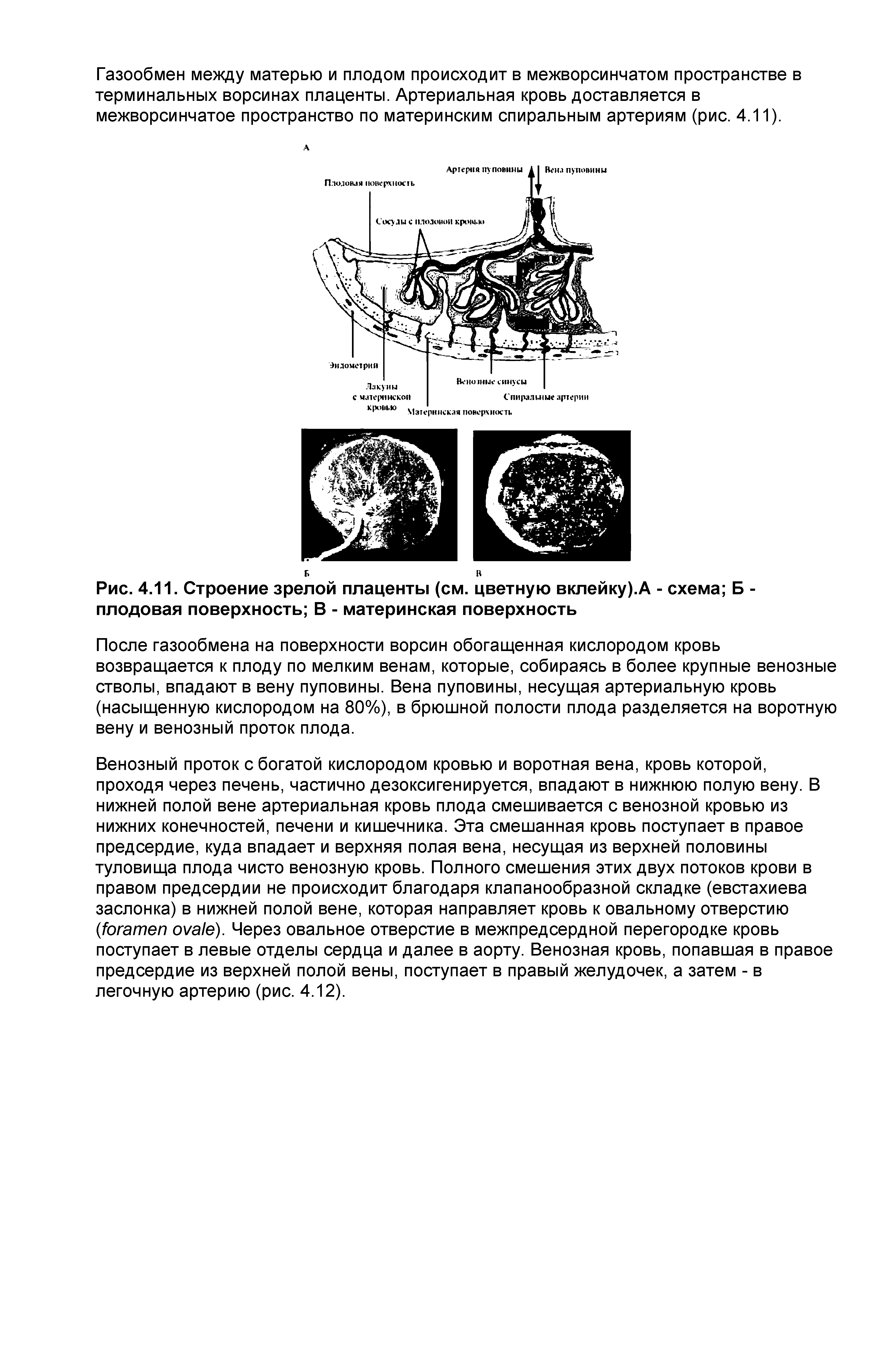 Рис. 4.11. Строение зрелой плаценты (см. цветную вклейку).А - схема Б -плодовая поверхность В - материнская поверхность...