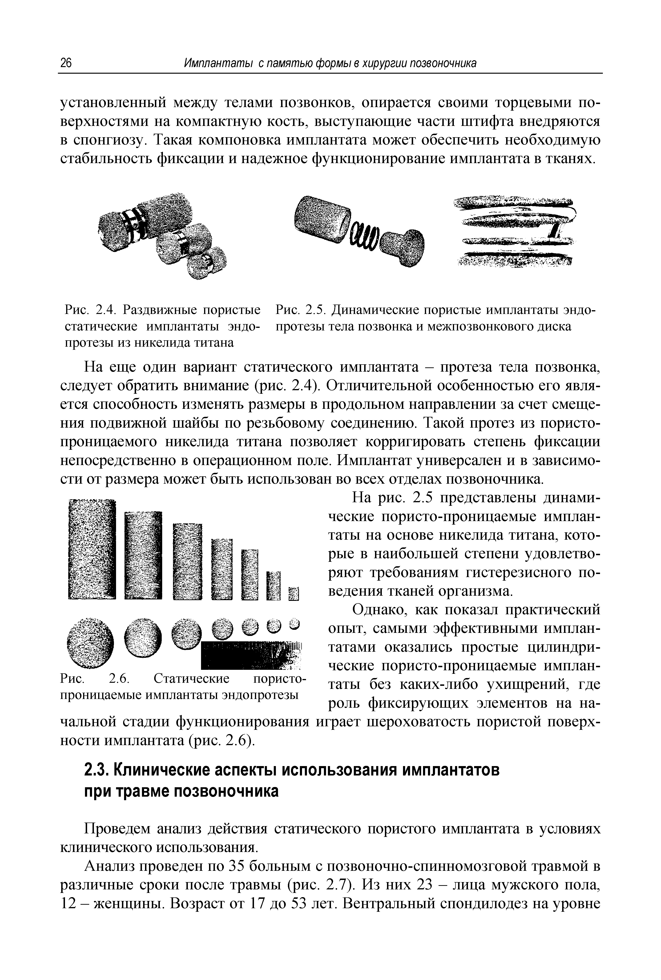 Рис. 2.4. Раздвижные пористые Рис. 2.5. Динамические пористые имплантаты эндо-статические имплантаты эндо- протезы тела позвонка и межпозвонкового диска протезы из никелида титана...