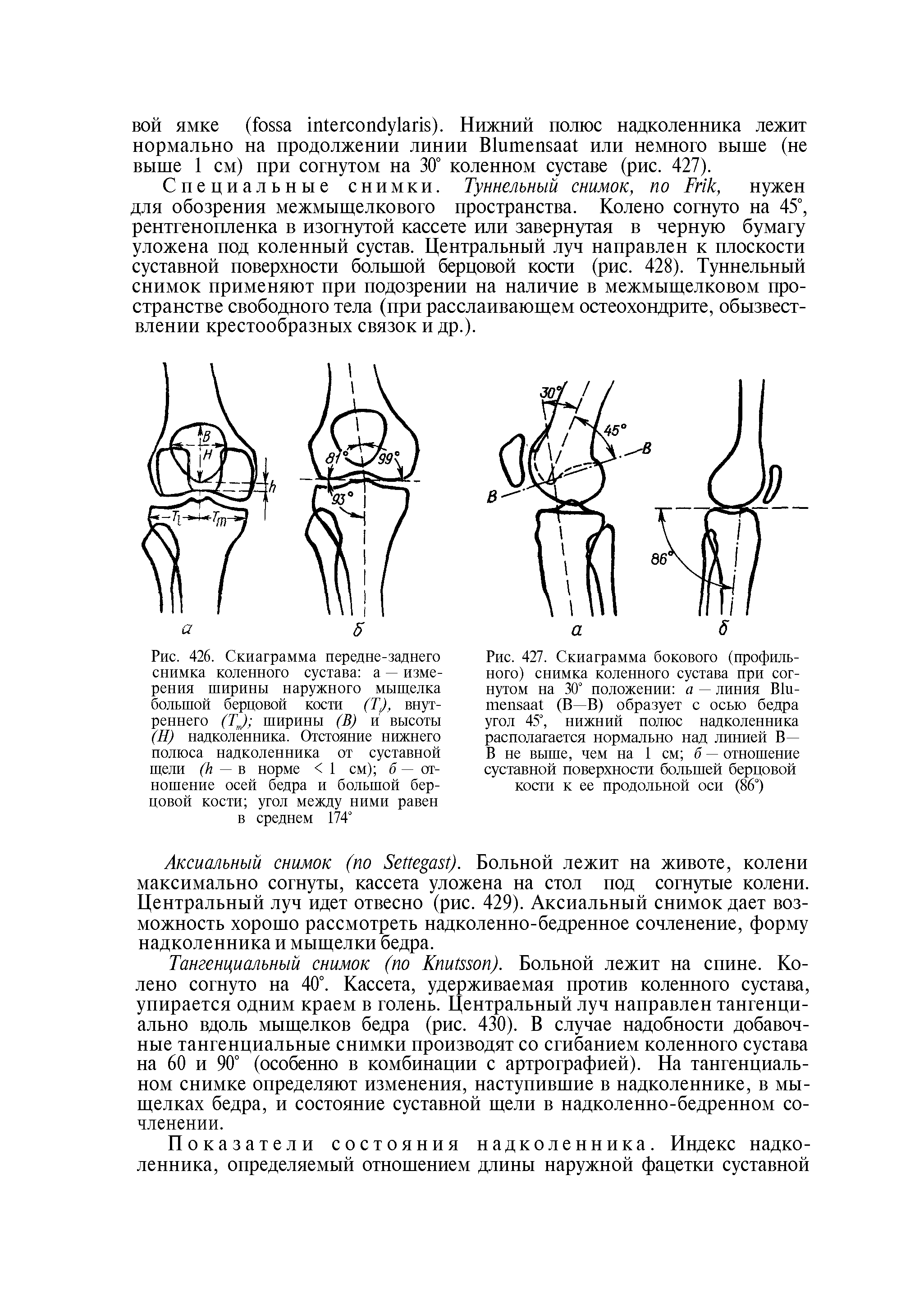 Рис. 427. Скиаграмма бокового (профильного) снимка коленного сустава при согнутом на 30° положении а — линия В1и-тепзаа (В—В) образует с осью бедра угол 45°, нижний полюс надколенника располагается нормально над линией В— В не выше, чем на 1 см б — отношение суставной поверхности большей берцовой кости к ее продольной оси (86°)...