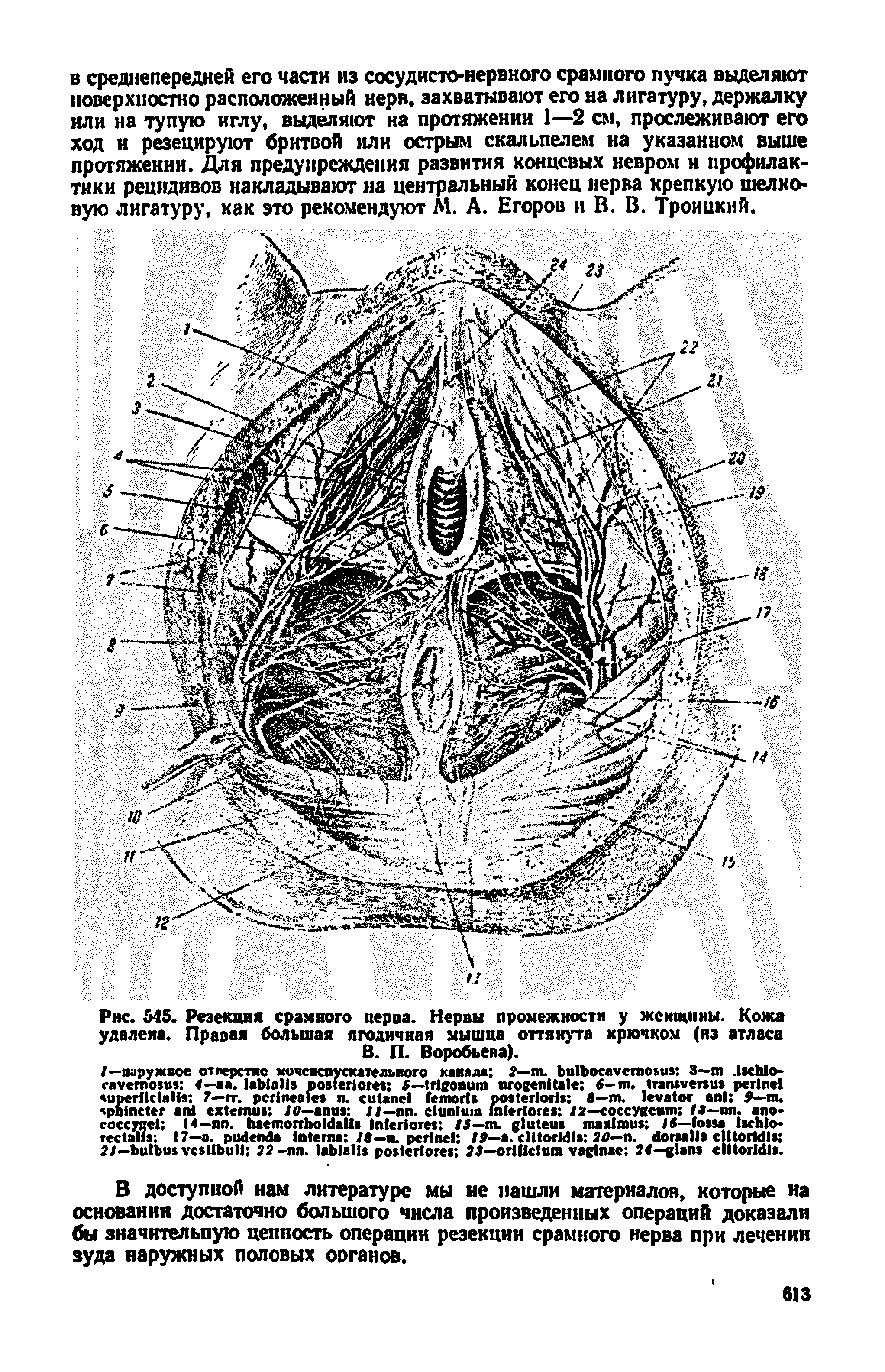 Рис. 545. Резекция срамного нерва. Нервы промежности у женщины. Кожа удалена. Правая большая ягодичная мышца оттянута крючком (нз атласа В. П. Воробьева).