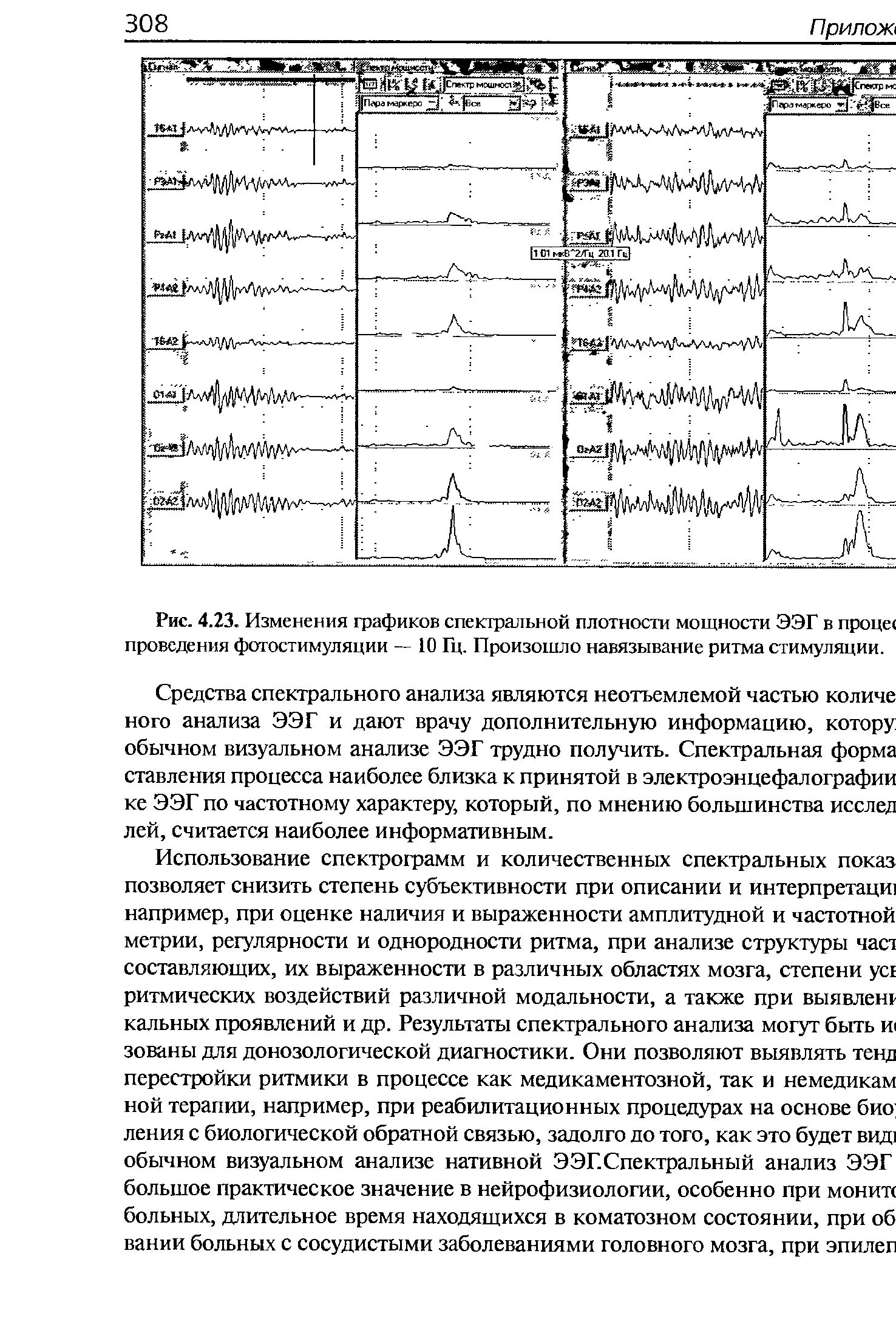 Рис. 4.23. Изменения графиков спектральной плотности мощности ЭЭГ в пронес проведения фотостимуляции — 10 Гц. Произошло навязывание ритма стимуляции.