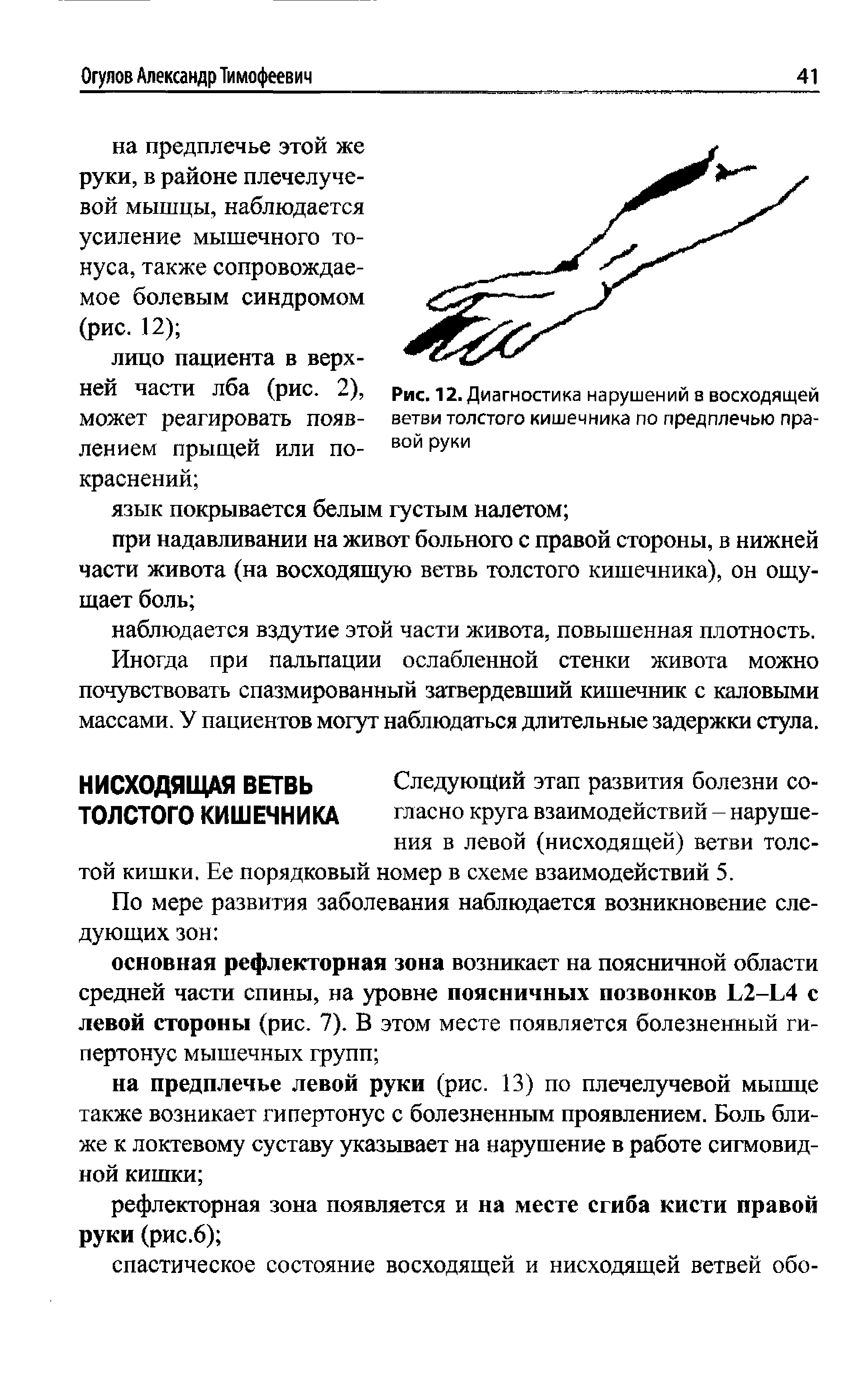 Рис. 12. Диагностика нарушений в восходящей ветви толстого кишечника по предплечью правой руки...