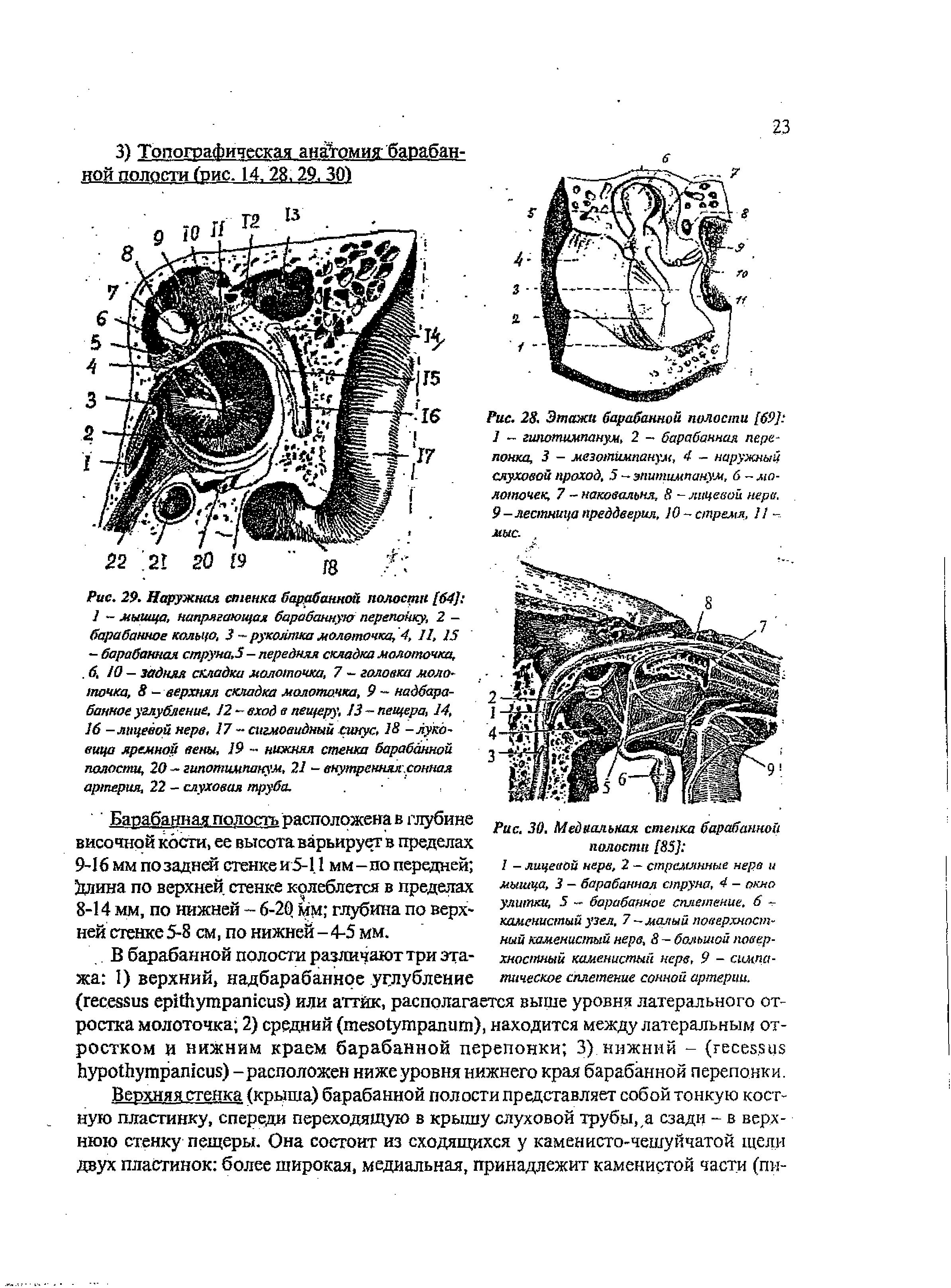 Рис. 28. Этажи барабанной полости [69] 1 - гипотимпанум, 2 - барабанная перепонка, 3 - мезотимпанум, 4 - наружный слуховой проход, 5 -эпитимпанум, 6 -молоточек, 7 -наковальня, 8 - лицевой нерв. 9—лестница преддверия, 10 - стремя, И -мыс., ...