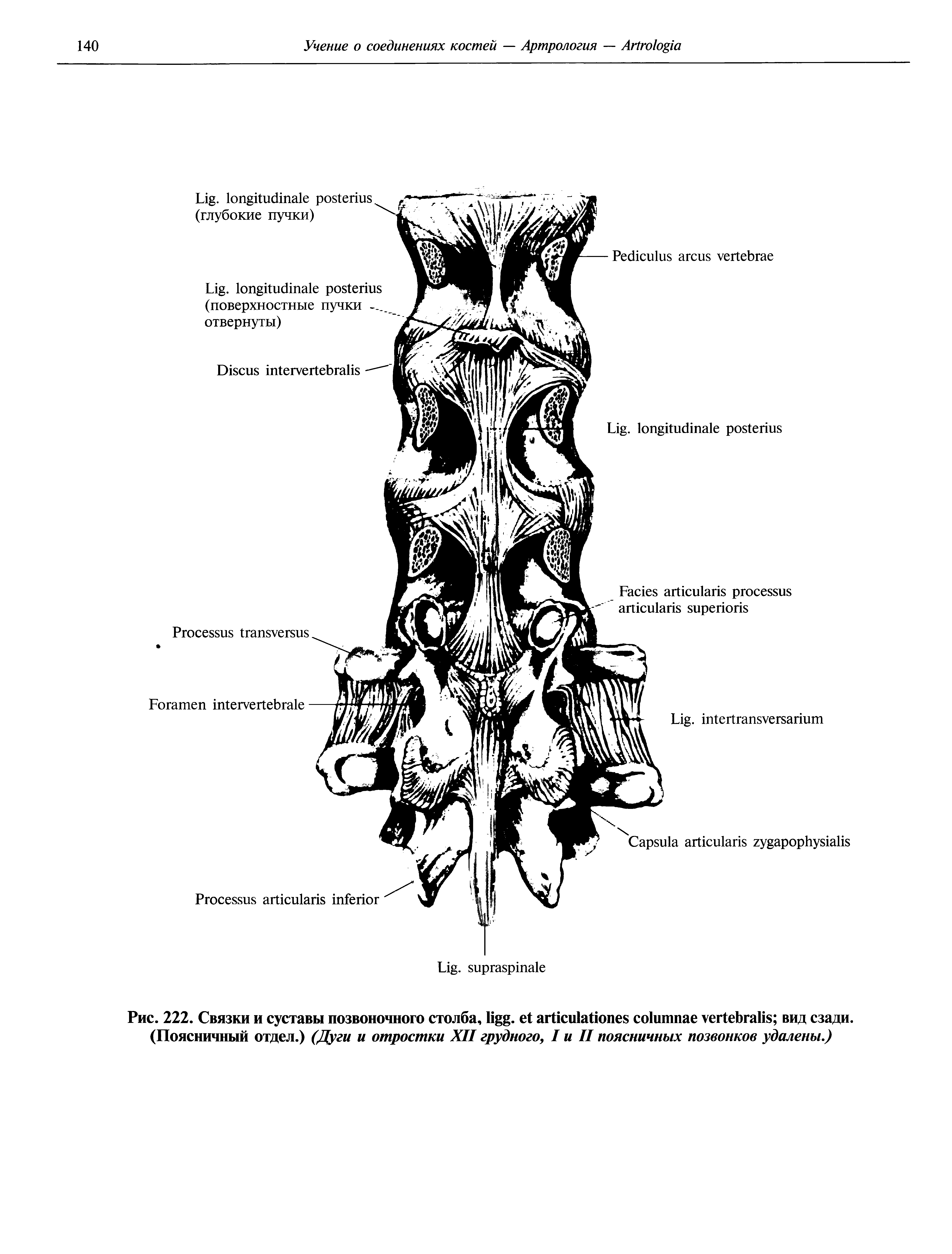 Рис. 222. Связки и суставы позвоночного столба, . вид сзади. (Поясничный отдел.) (Дуги и отростки XII грудного, I и II поясничных позвонков удалены.)...