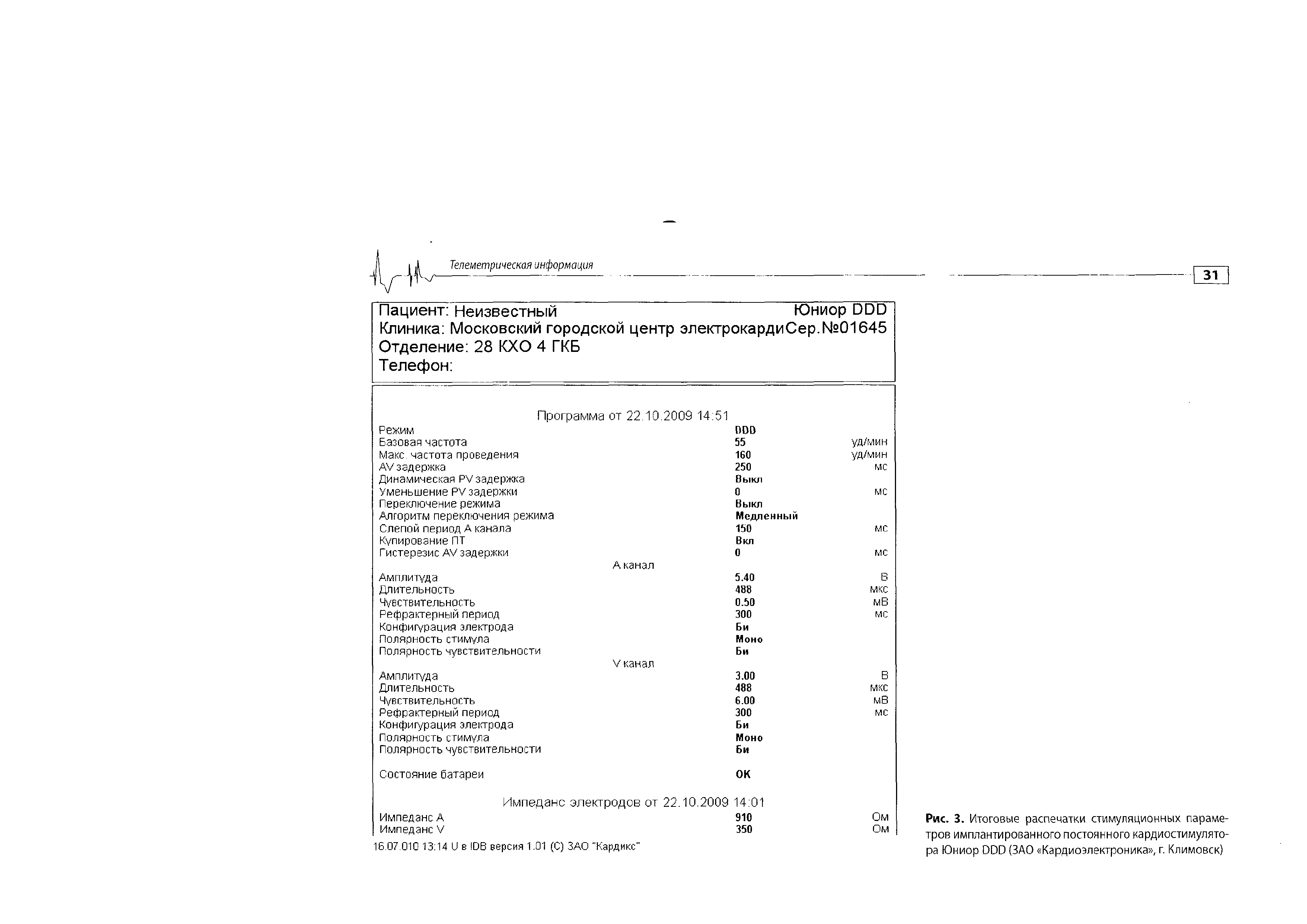 Рис. 3. Итоговые распечатки стимуляционных параметров имплантированного постоянного кардиостимулятора Юниор ОРО (ЗАО Кардиоэлектроника , г. Климовск)...