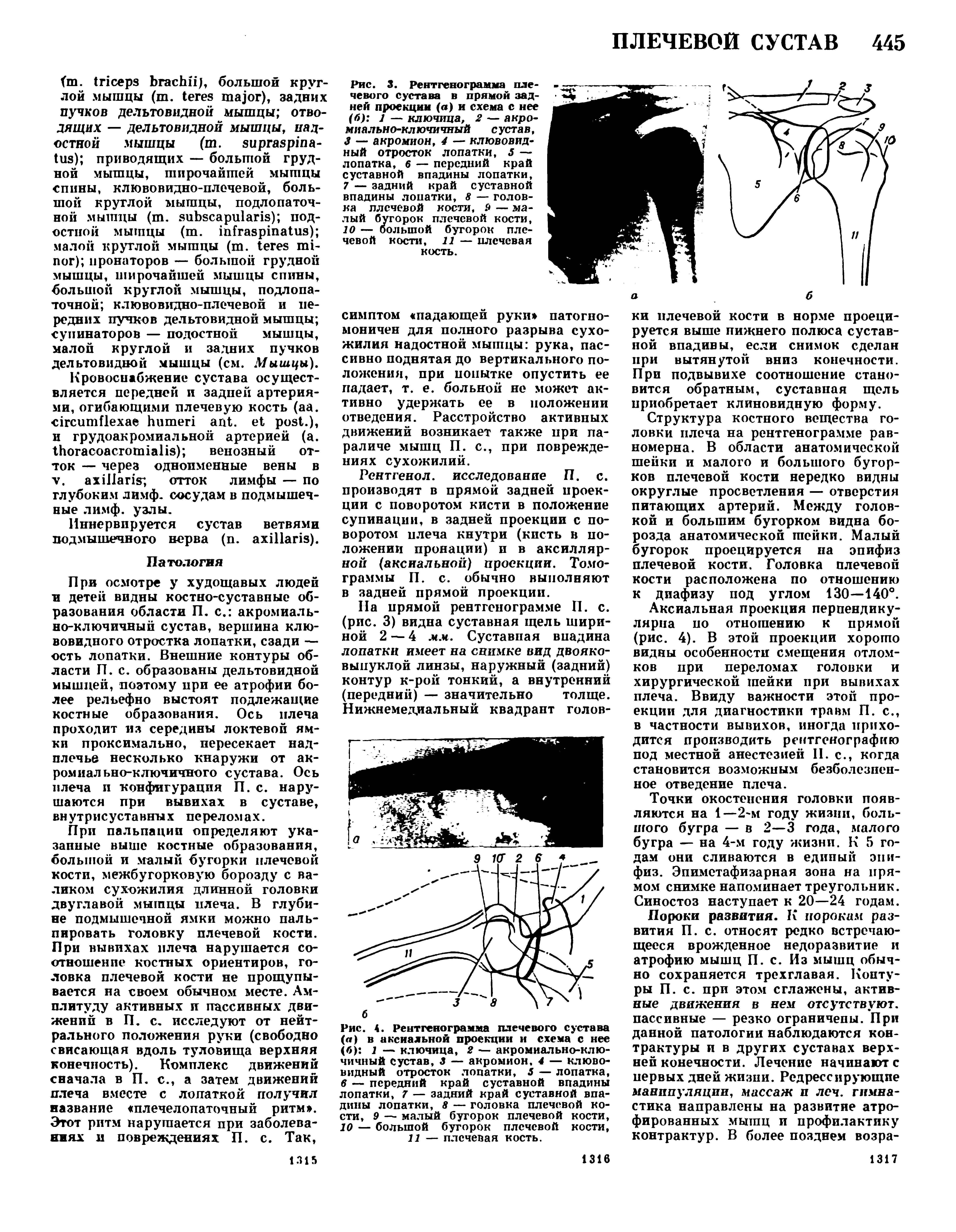 Рис. 3. Рентгенограмма плечевого сустава в прямой задней проекции (а) и схема с нее (б) 1 — ключица, 2 — акромиально-ключичный сустав, 3 — акромион, 4 — клювовидный отросток лопатки, 5 — лопатка, б — передний край суставной впадины лопатки, 7 — задний край суставной впадины лопатки, 8 — головка плечевой кости, Р — малый бугорок плечевой кости, 10 — большой бугорок плечевой кости, 11 — плечевая кость.