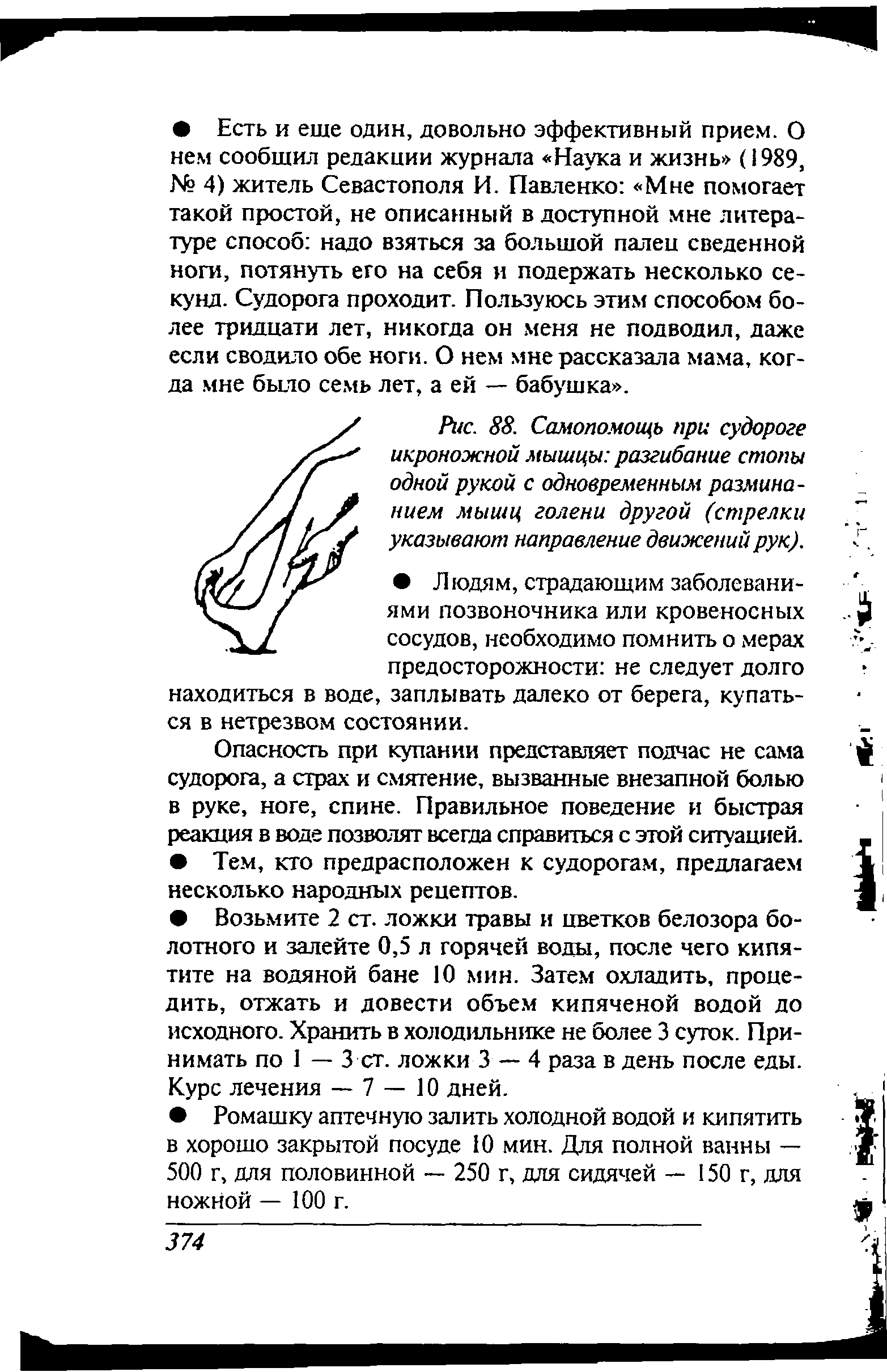 Рис. 88. Самопомощь при судороге икроножной мышцы разгибание стопы одной рукой с одновременным разминанием мышц голени другой (стрелки указывают направление движений рук).