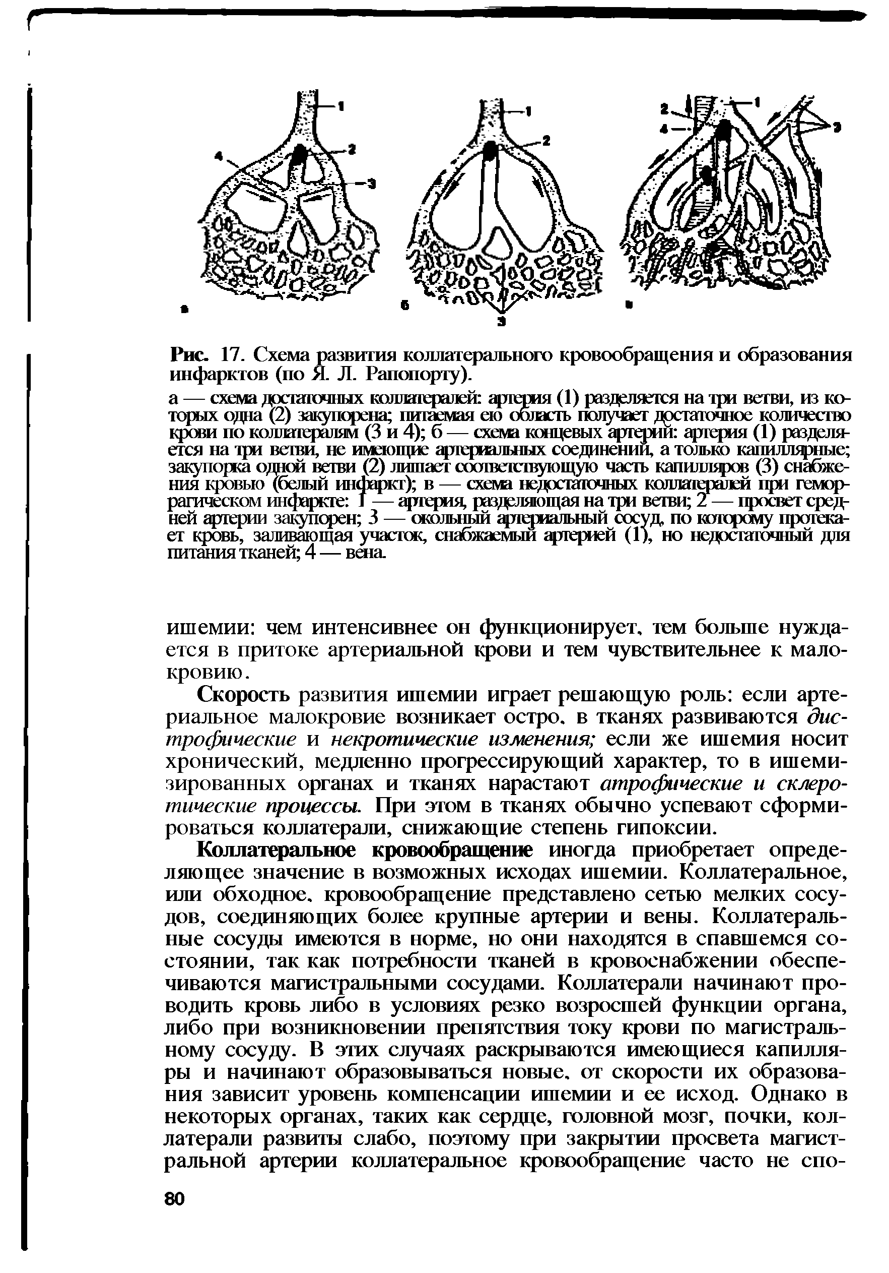 Рис. 17. Схема развития коллатерального кровообращения и образования инфарктов (по Я. Л. Рапопорту).