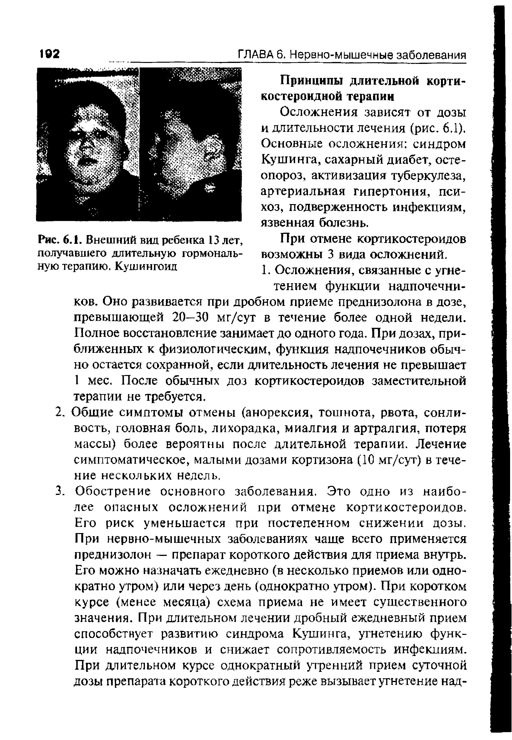 Рис. 6.1. Внешний вид ребенка 13 лет, получавшего длительную гормональную терапию. Кушингоид...