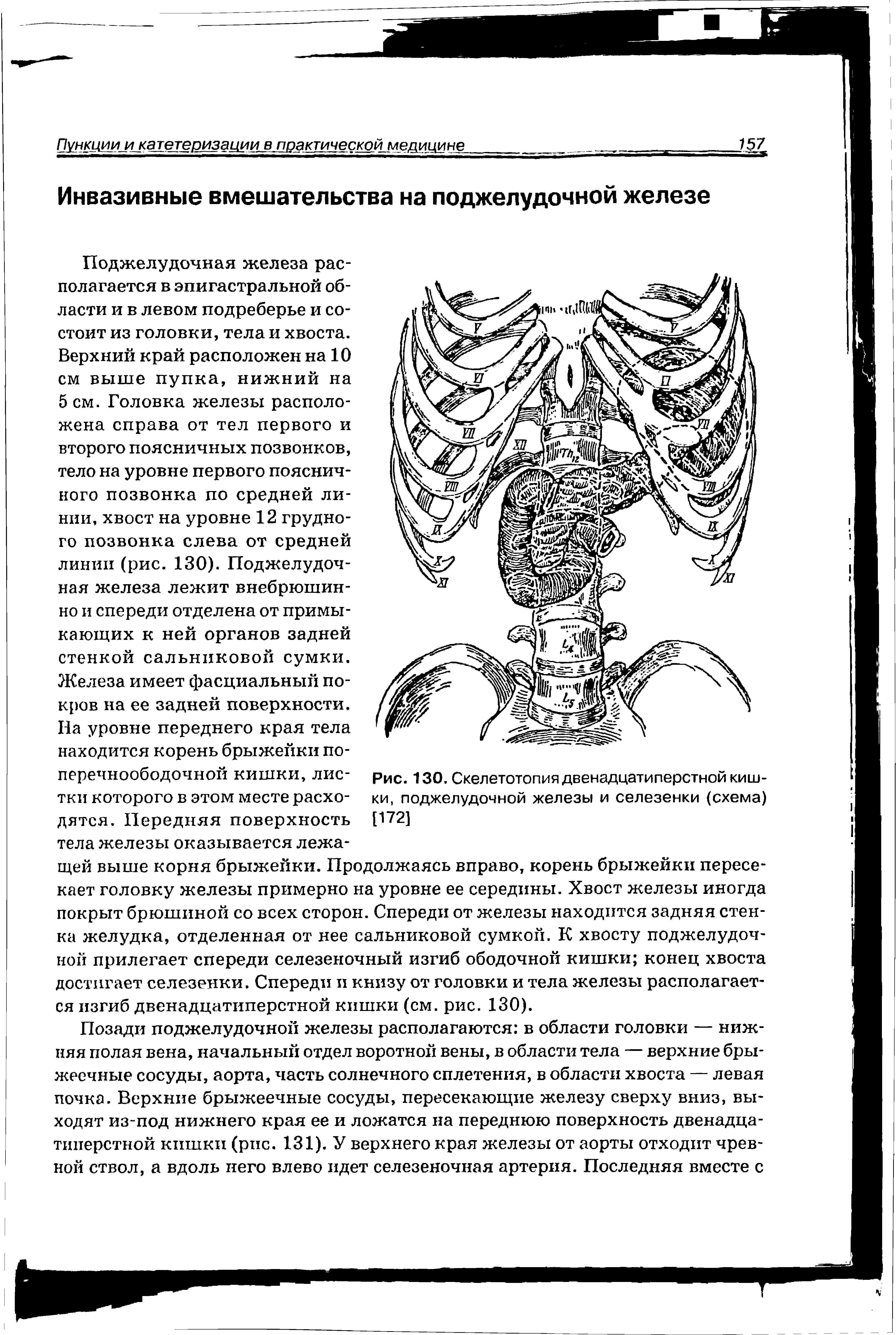 Рис. 130. Скелетотопия двенадцатиперстной кишки, поджелудочной железы и селезенки (схема) [172]...