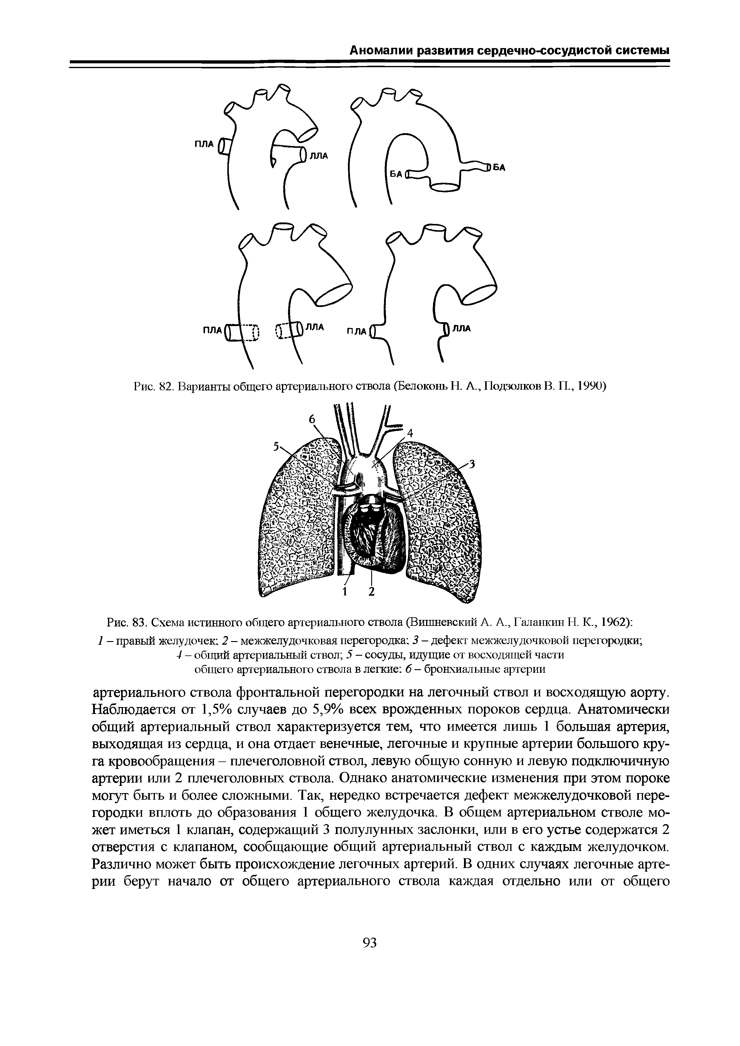Рис. 83. Схема истинного общего артериального ствола (Вишневский А. А., Галанкин Н. К., 1962) ...