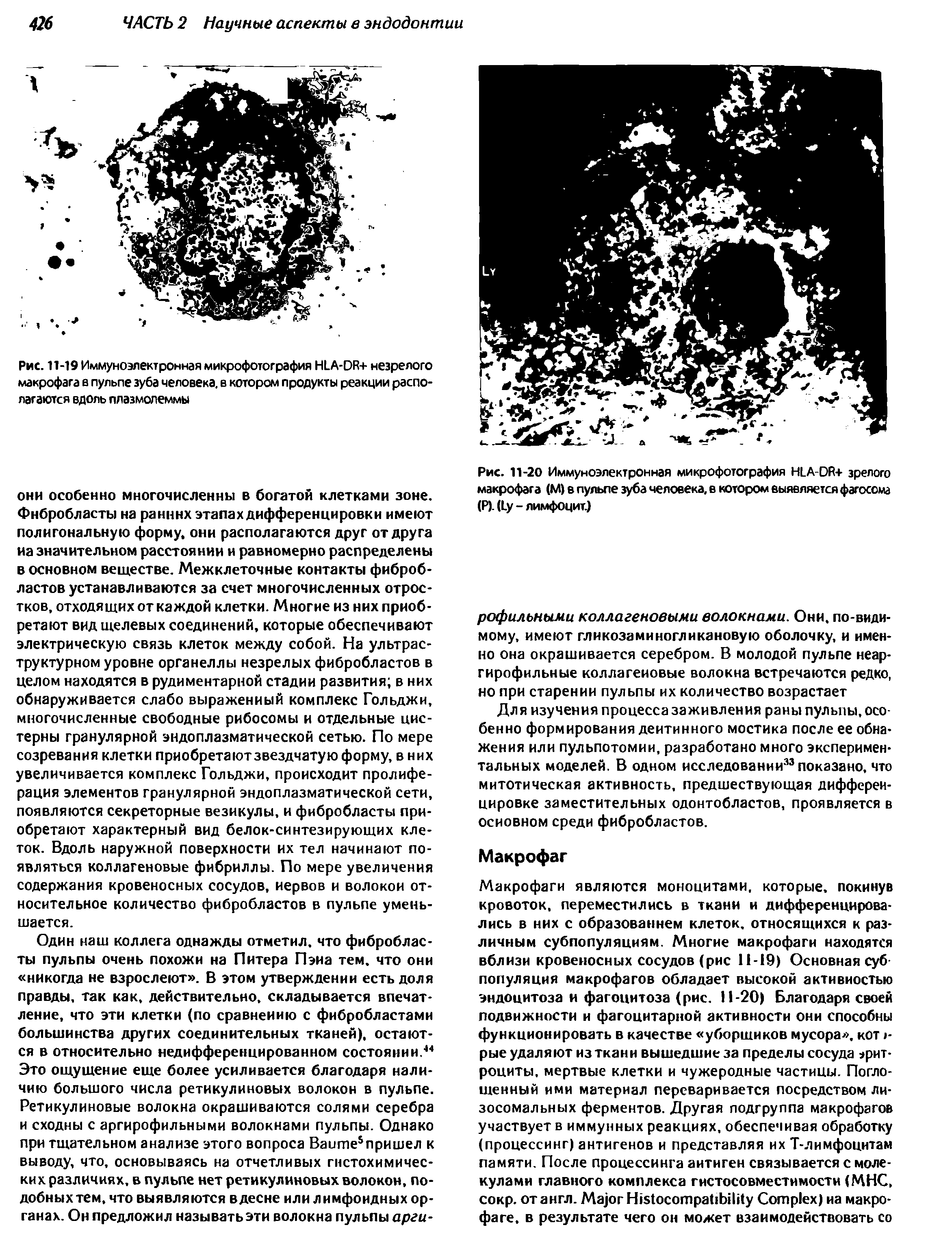 Рис. 11-19 Иммуноэлектронная микрофотография ША-ОК+ незрелого макрофага в пульпе зуба человека, в котором продукты реакции располагаются вдоль плазмолеммы...