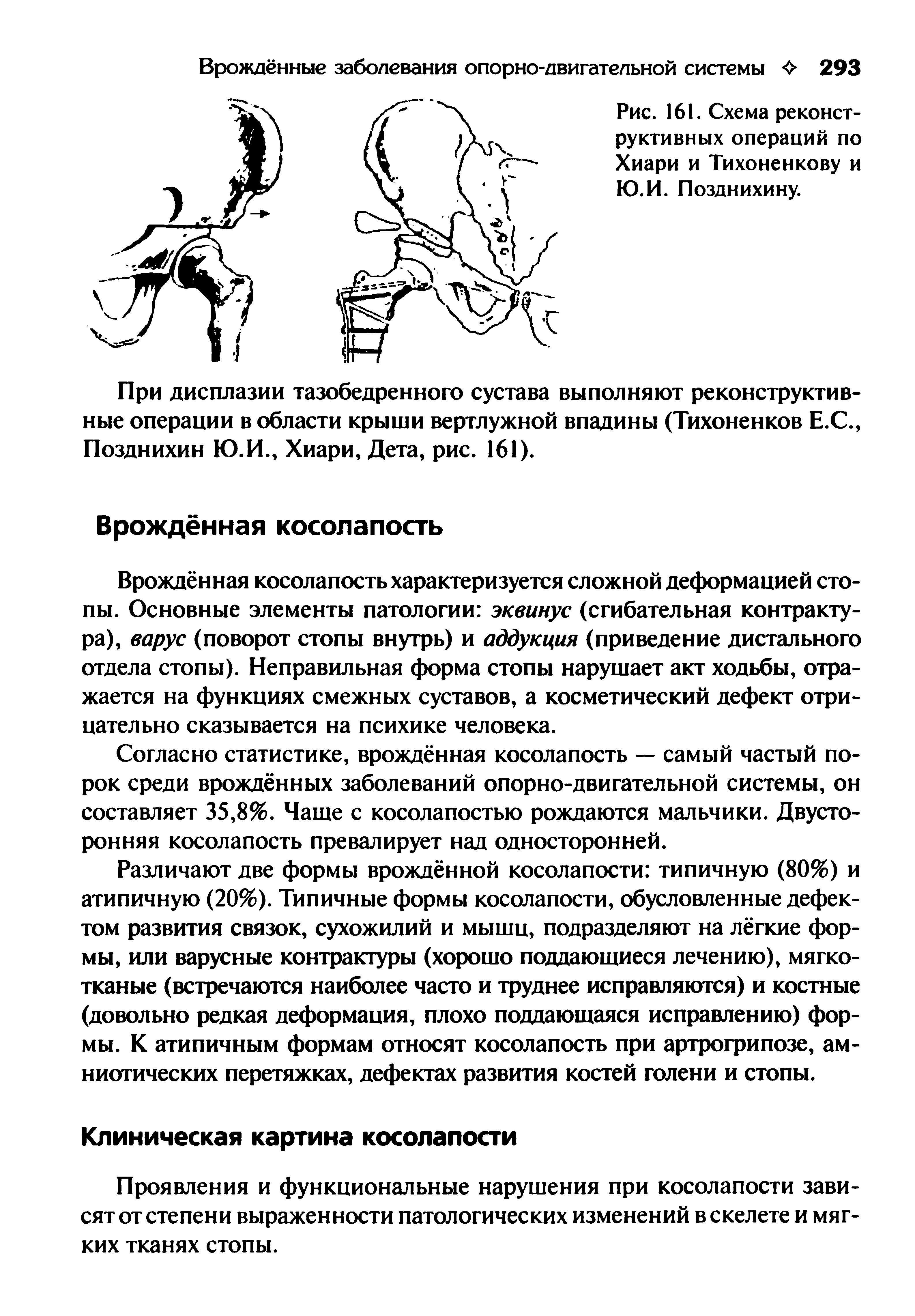 Рис. 161. Схема реконструктивных операций по Хиари и Тихоненкову и Ю.И. Позднихину.