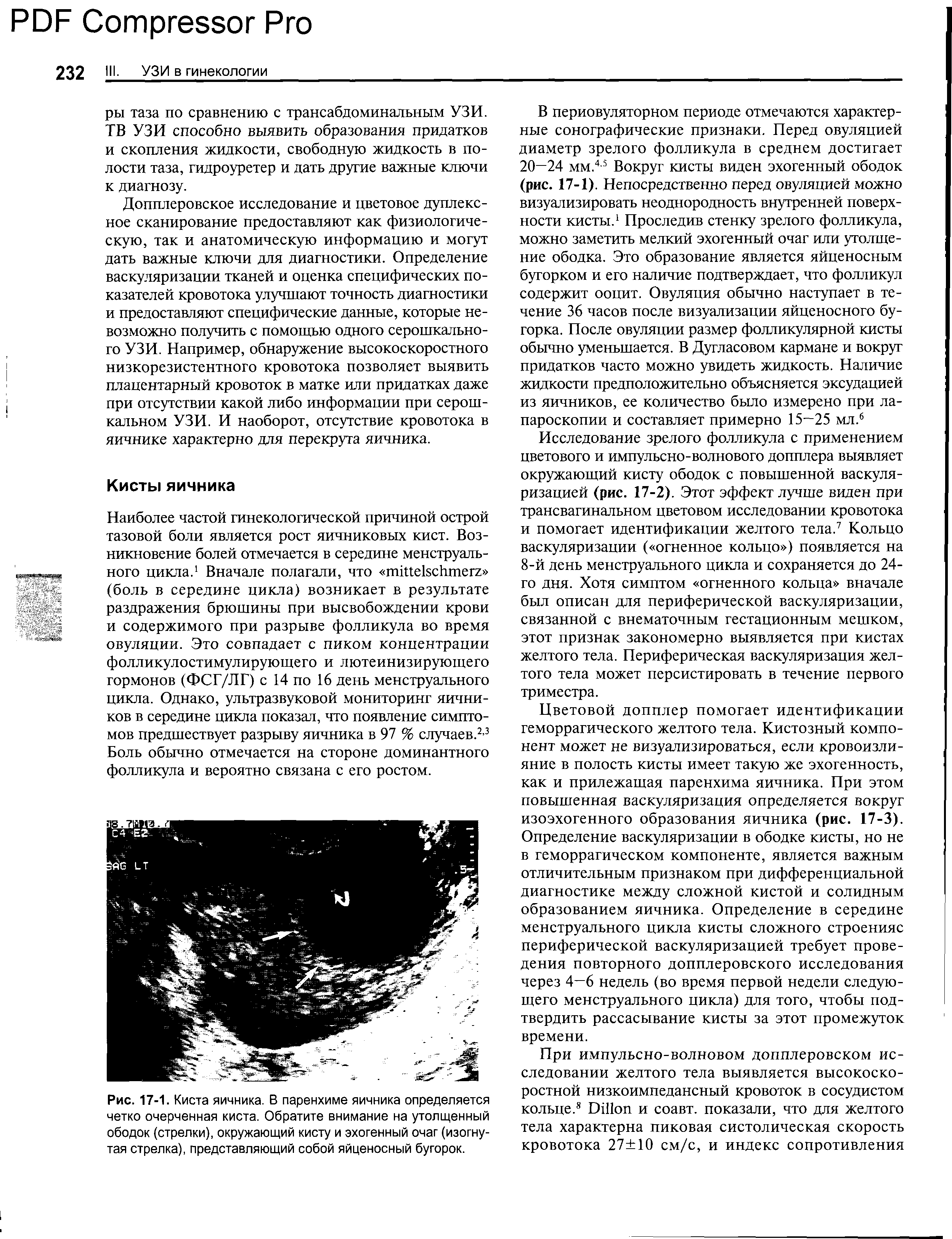 Рис. 17-1. Киста яичника. В паренхиме яичника определяется четко очерченная киста. Обратите внимание на утолщенный ободок (стрелки), окружающий кисту и эхогенный очаг (изогнутая стрелка), представляющий собой яйценосный бугорок.