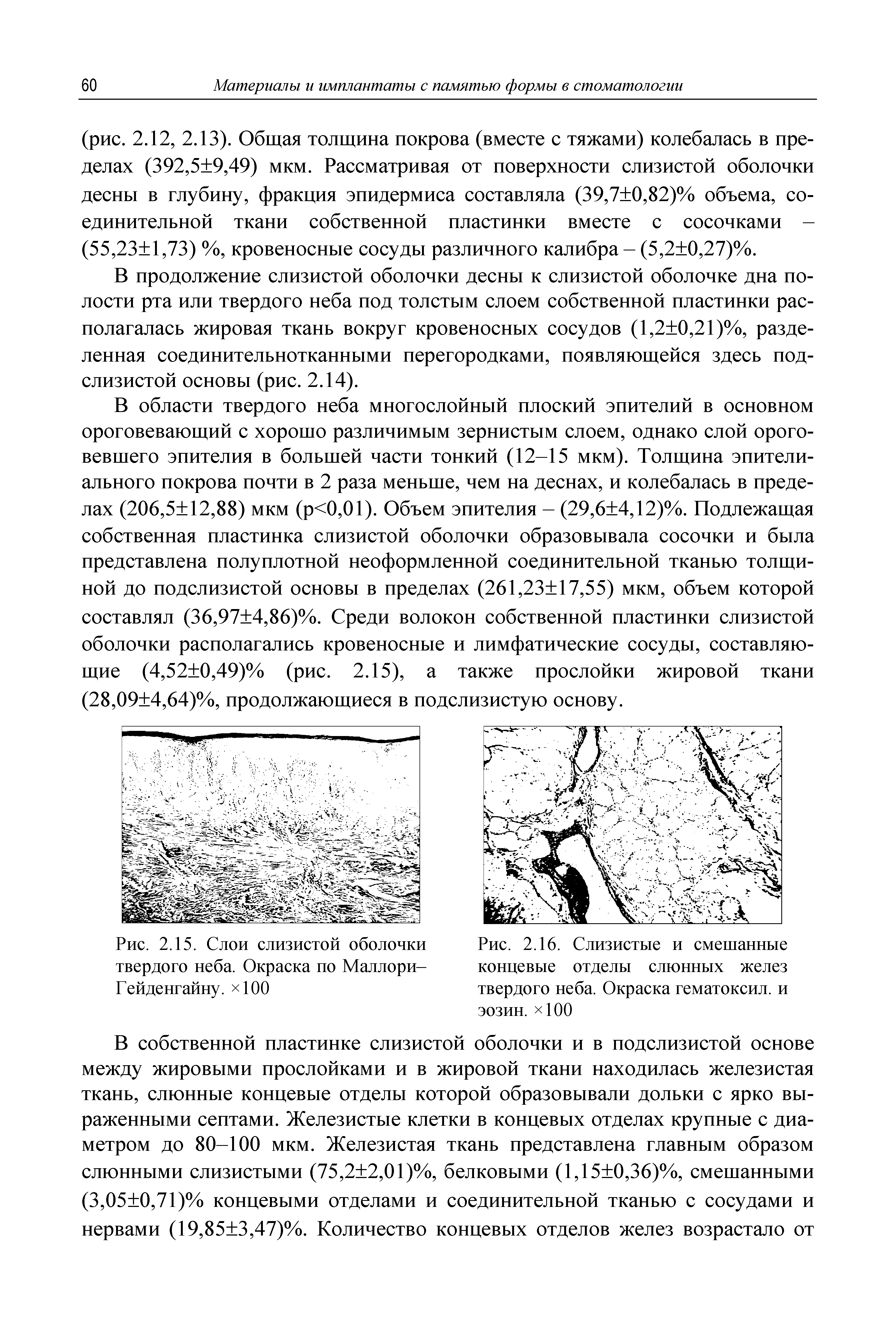 Рис. 2.16. Слизистые и смешанные концевые отделы слюнных желез твердого неба. Окраска гематоксил. и эозин. 100...