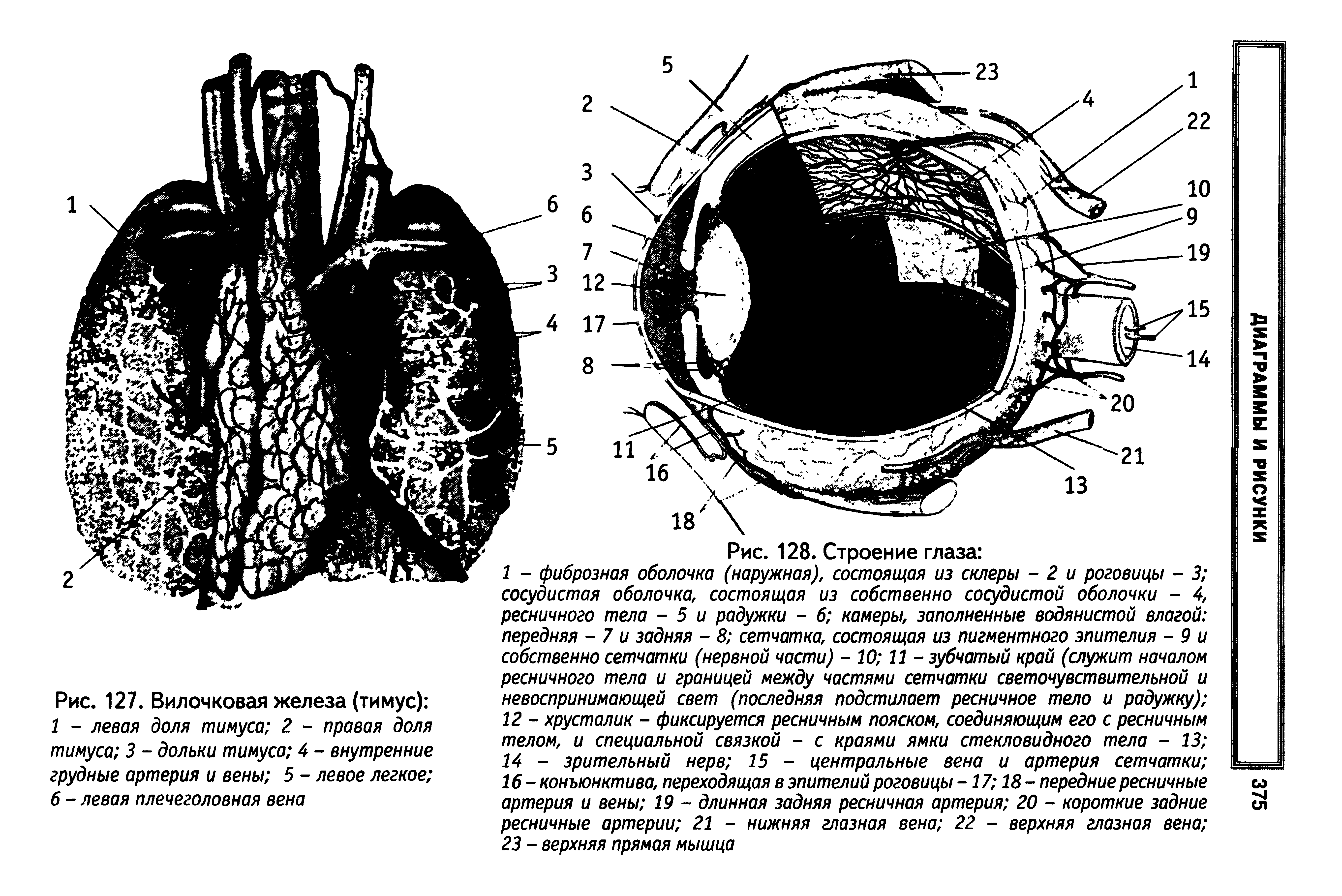 Рис. 127. Вилочковая железа (тимус) 1 - левая доля тимуса 2 - правая доля тимуса 3 - дольки тимуса 4 - внутренние грудные артерия и вены 5 - левое легкое 6 - левая плечеголовная вена...