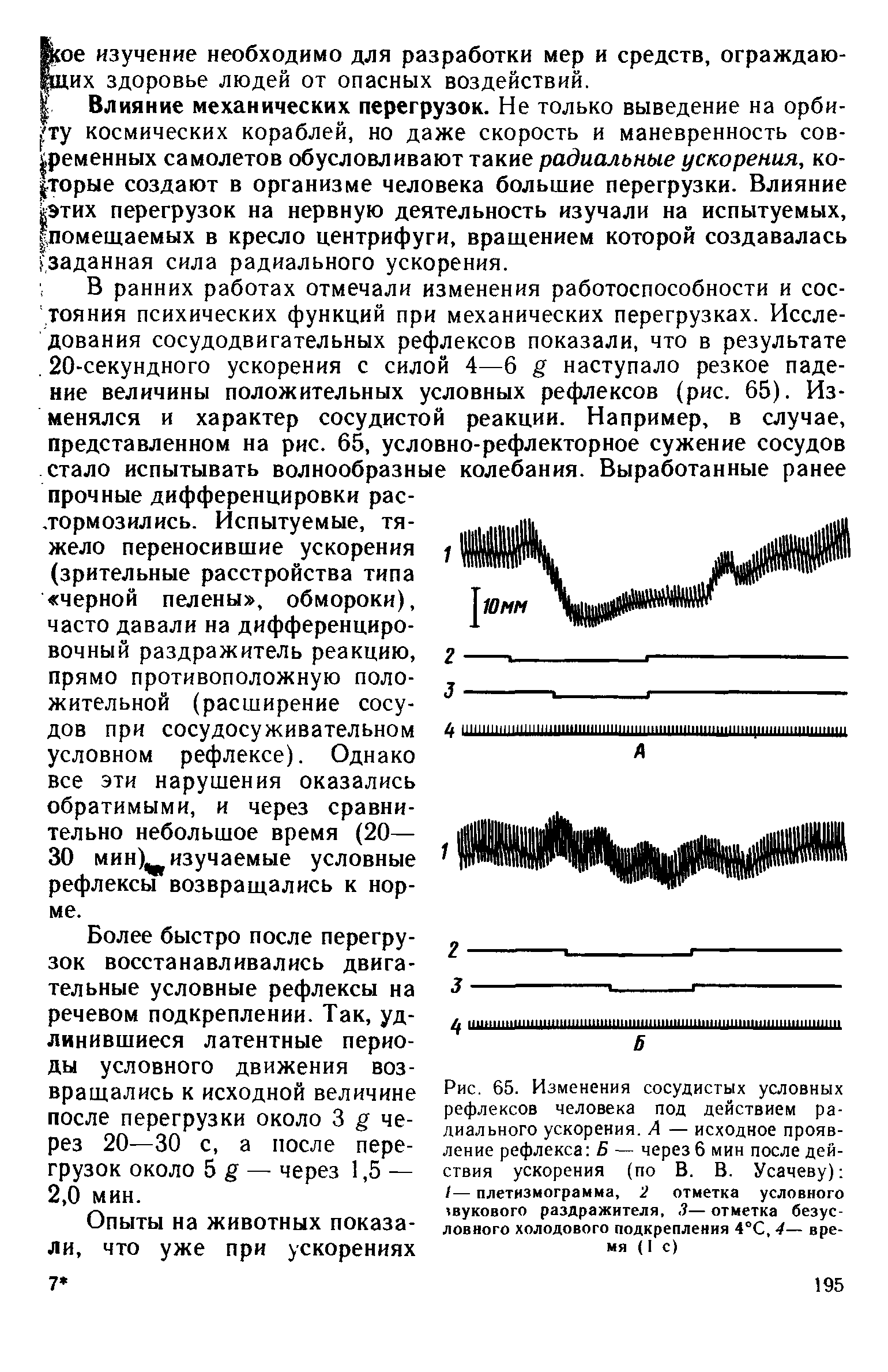 Рис. 65. Изменения сосудистых условных рефлексов человека под действием радиального ускорения. А — исходное проявление рефлекса Б — через 6 мин последействия ускорения (по В. В. Усачеву) /— плетизмограмма, 2 отметка условного звукового раздражителя, 3— отметка безусловного холодового подкрепления 4°С, 4— время (1с)...