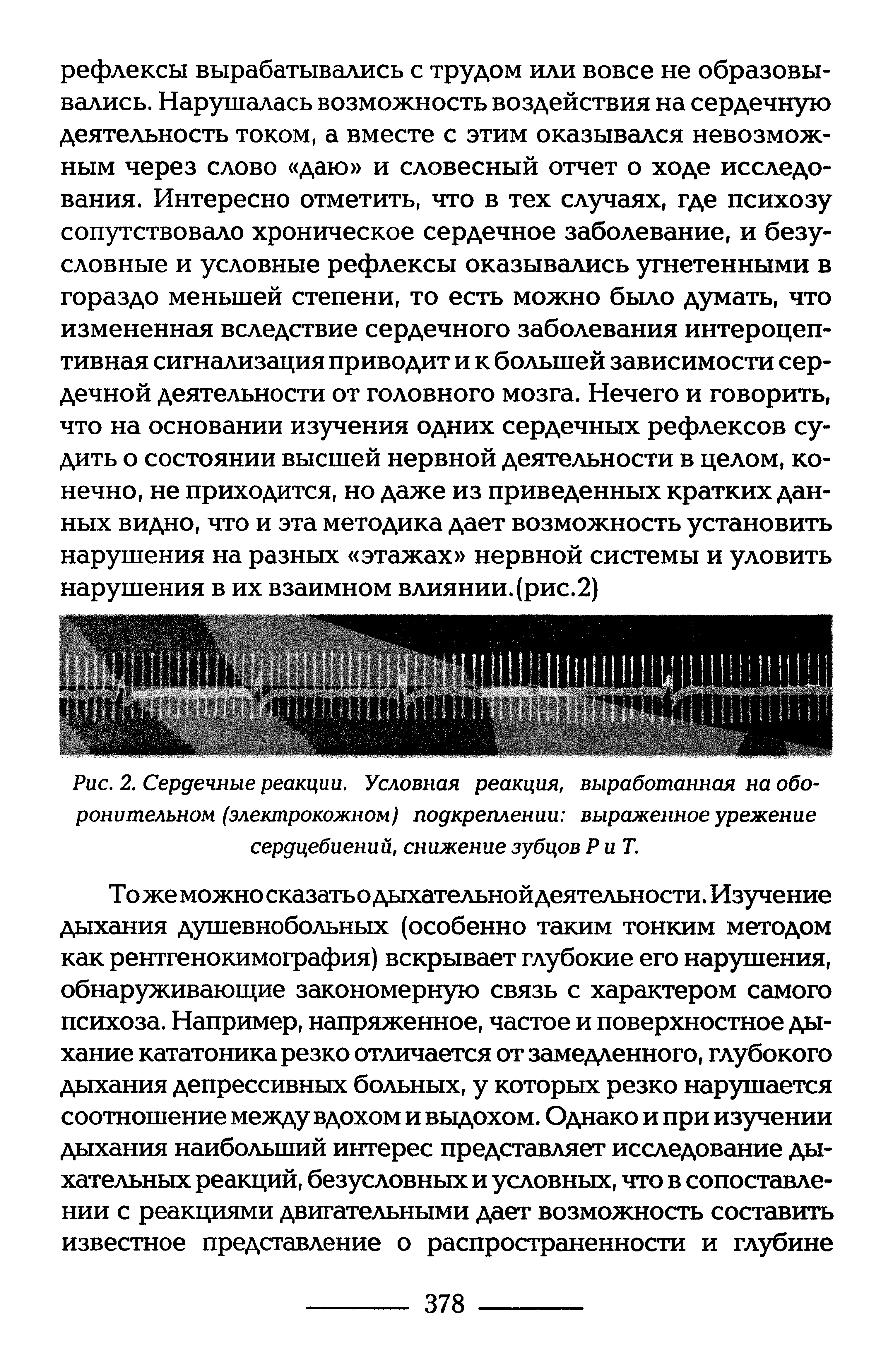 Рис. 2. Сердечные реакции. Условная реакция, выработанная на оборонительном (электрокожном) подкреплении выраженное урежение сердцебиений, снижение зубцов РиТ.