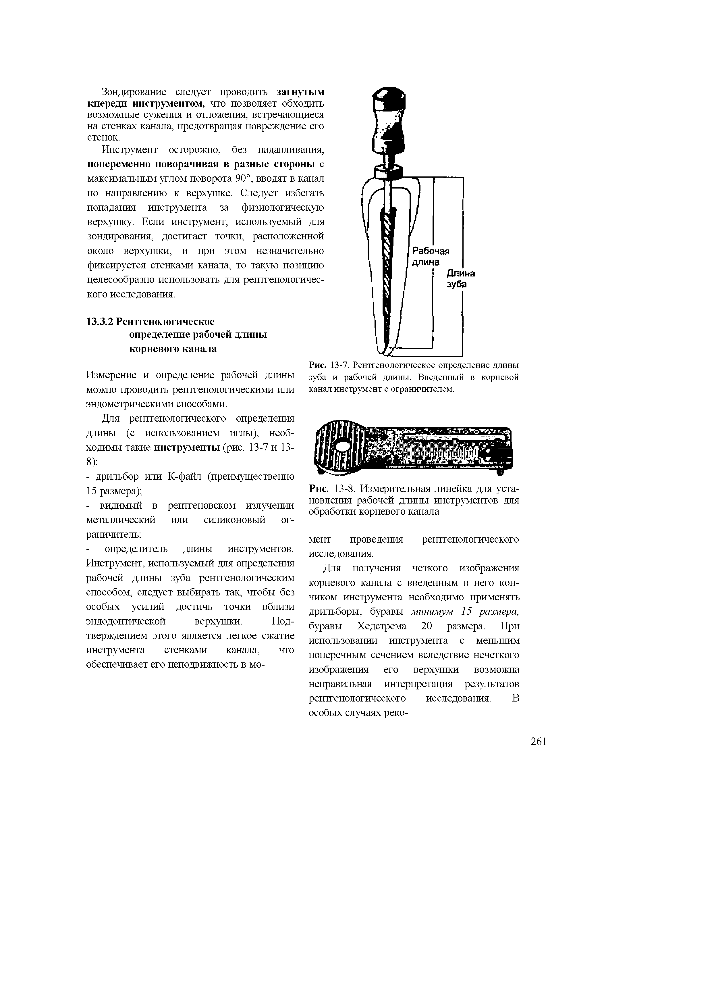 Рис. 13-7. Рентгенологическое определение длины зуба и рабочей длины. Введенный в корневой...