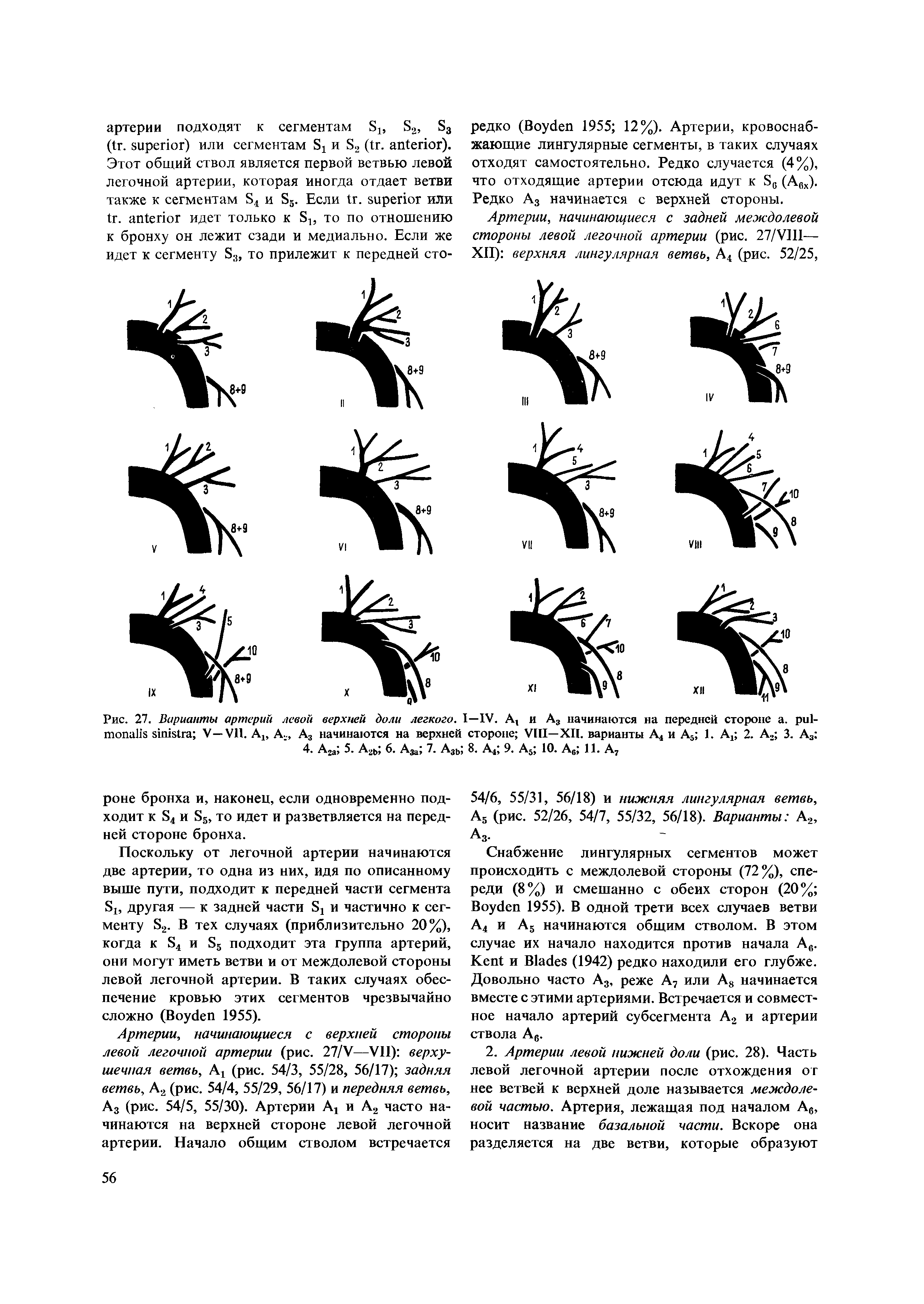 Рис. 27. Варианты артерий левой верхней доли легкого. I—IV. A и А3 начинаются на передней стороне . - V—V . Аъ A2> A3 начинаются на верхней стороне VIII—XII. варианты А4 и А5 1. А4 2. А2 3. А3 ...