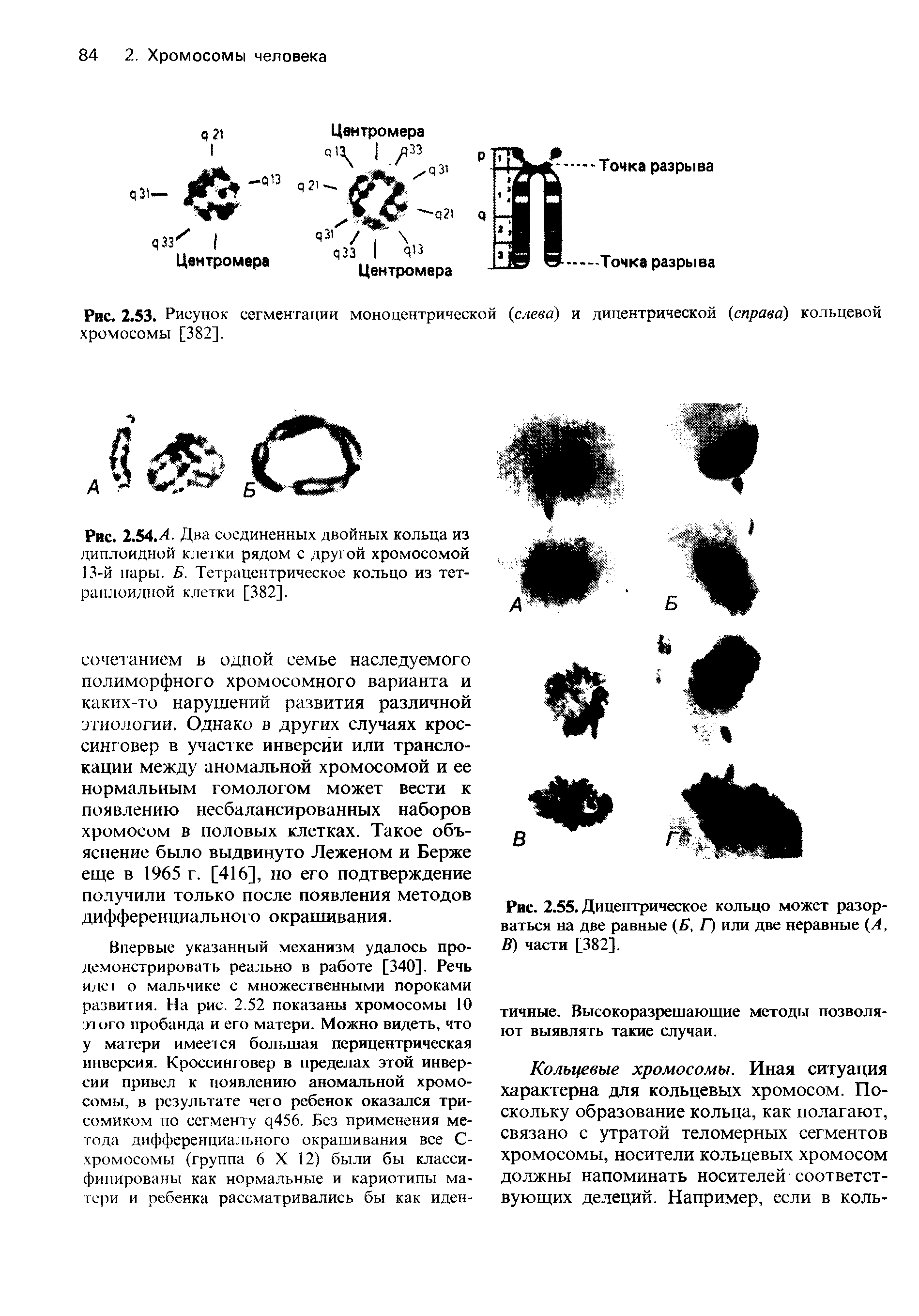 Рис. 2.54.4. Два соединенных двойных кольца из диплоидной клетки рядом с другой хромосомой 13-й пары. Б. Тетрацентрическое кольцо из тет-раплоидной клетки [382].
