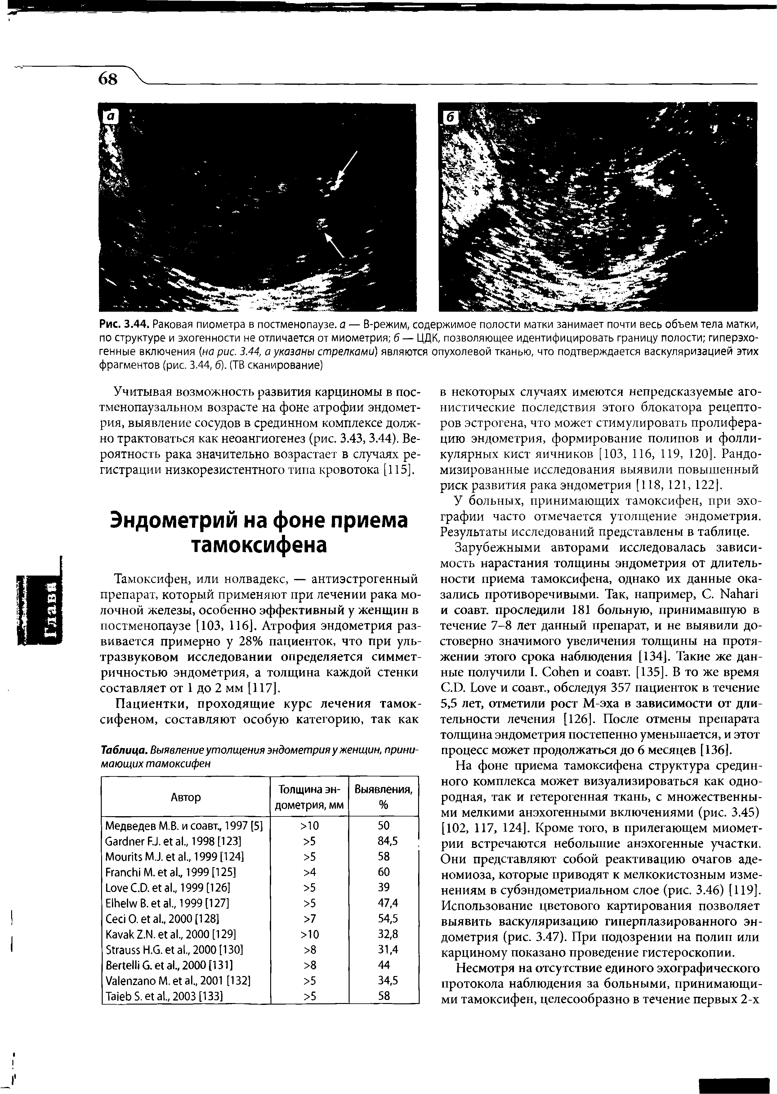 Таблица. Выявление утолщения эндометрия у женщин, принимающих тамоксифен...