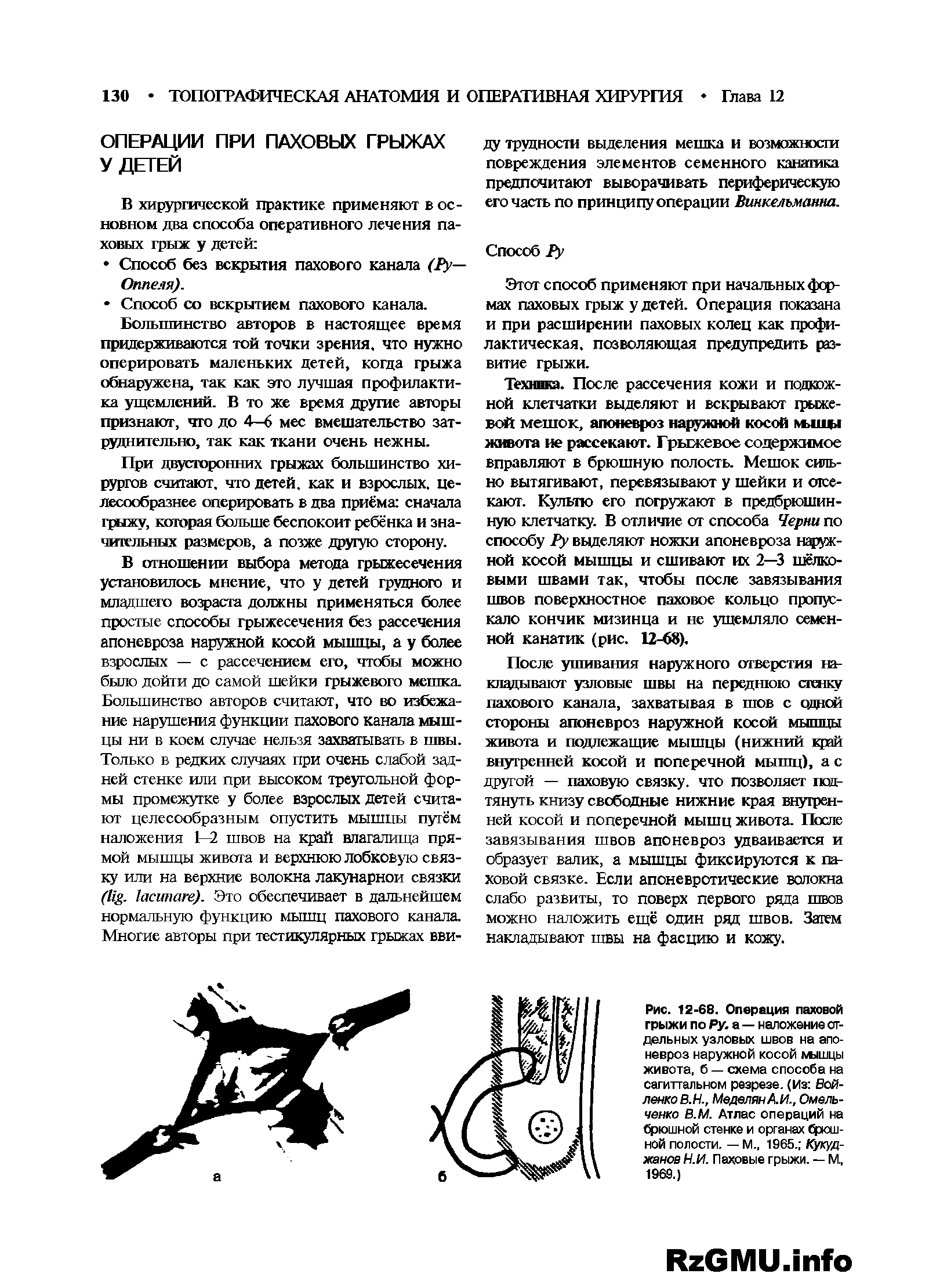 Рис. 12-68. Операция паховой грыжи по Ру. а — наложение отдельных узловых швов на апоневроз наружной косой мшцы живота, б — схема способа на сагиттальном резрезе. (Из Вой-ленкоВ.Н., МеделянА.И., Омельченко В.М. Атлас операций на брюшной стенке и органах брюшной полости. — М., 1965. Кукуд-жанов Н.И. Паховые грыжи. — М., 1969.)...