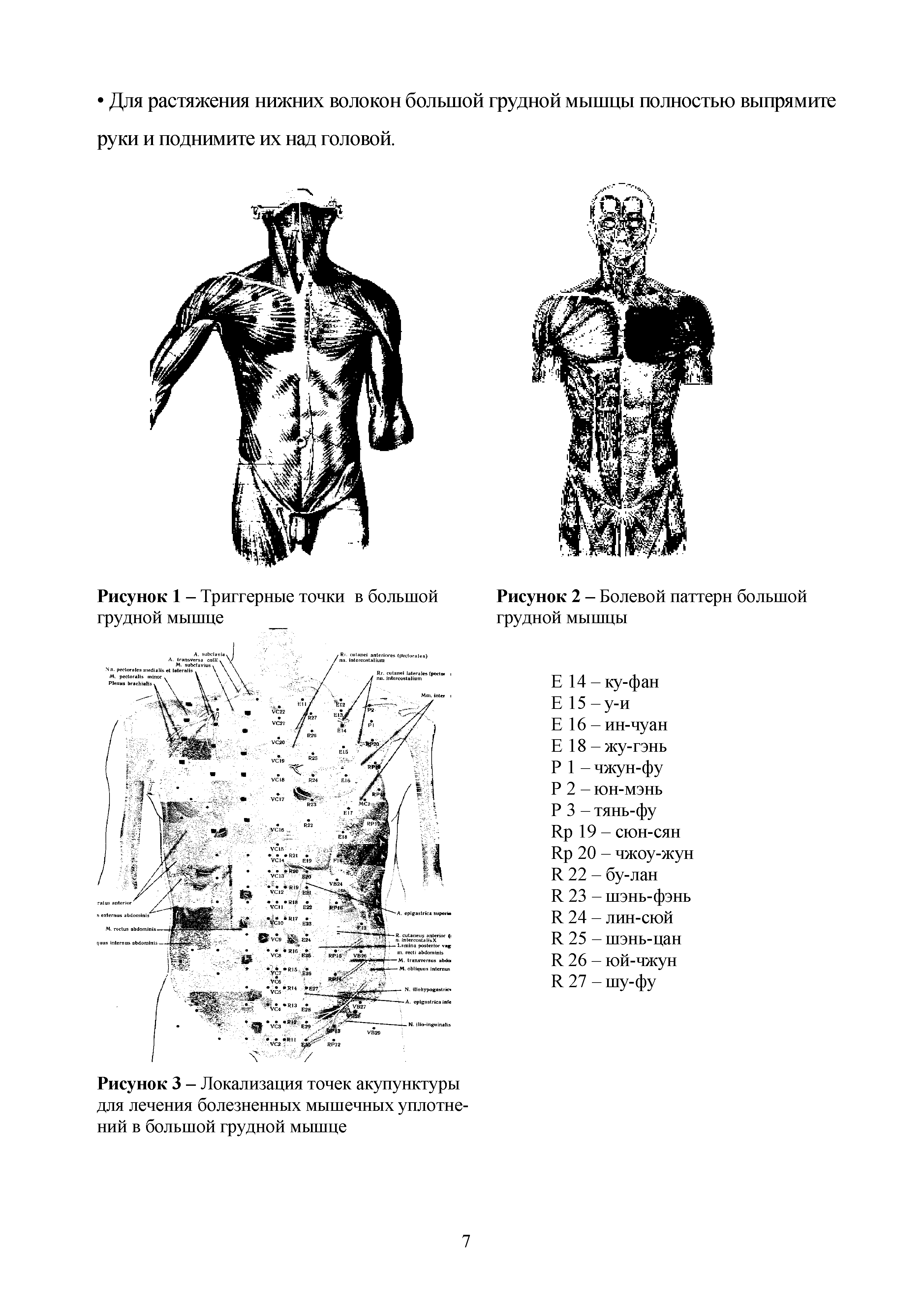 Рисунок 3 - Локализация точек акупунктуры для лечения болезненных мышечных уплотнений в большой грудной мышце...