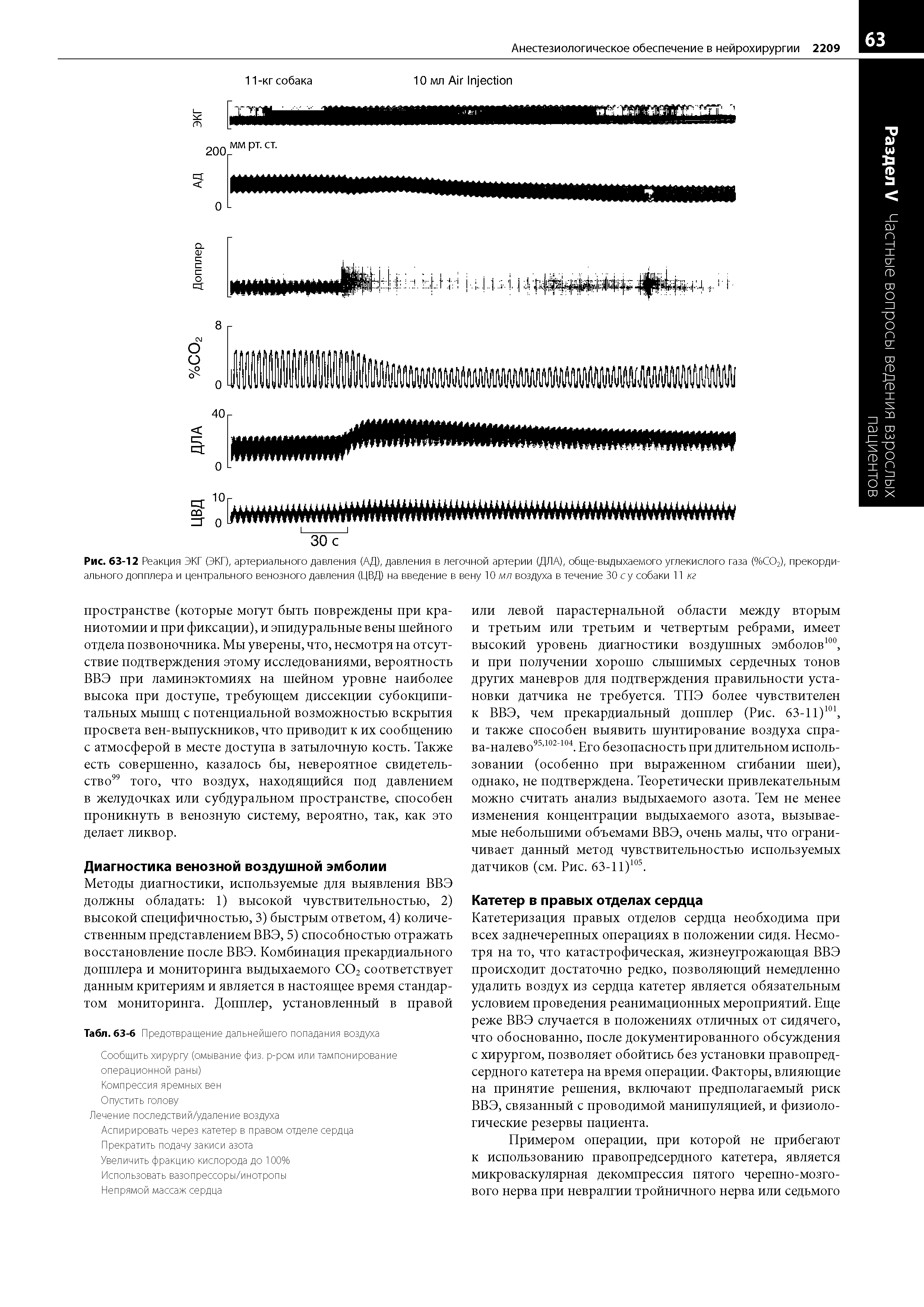 Рис. 63-12 Реакция ЭКГ (ЭКГ), артериального давления (АД), давления в легочной артерии (ДЛА), обще-выдыхаемого углекислого газа (%СО2), прекордиального допплера и центрального венозного давления (ЦВД) на введение в вену 10 мл воздуха в течение 30 су собаки 11 кг...