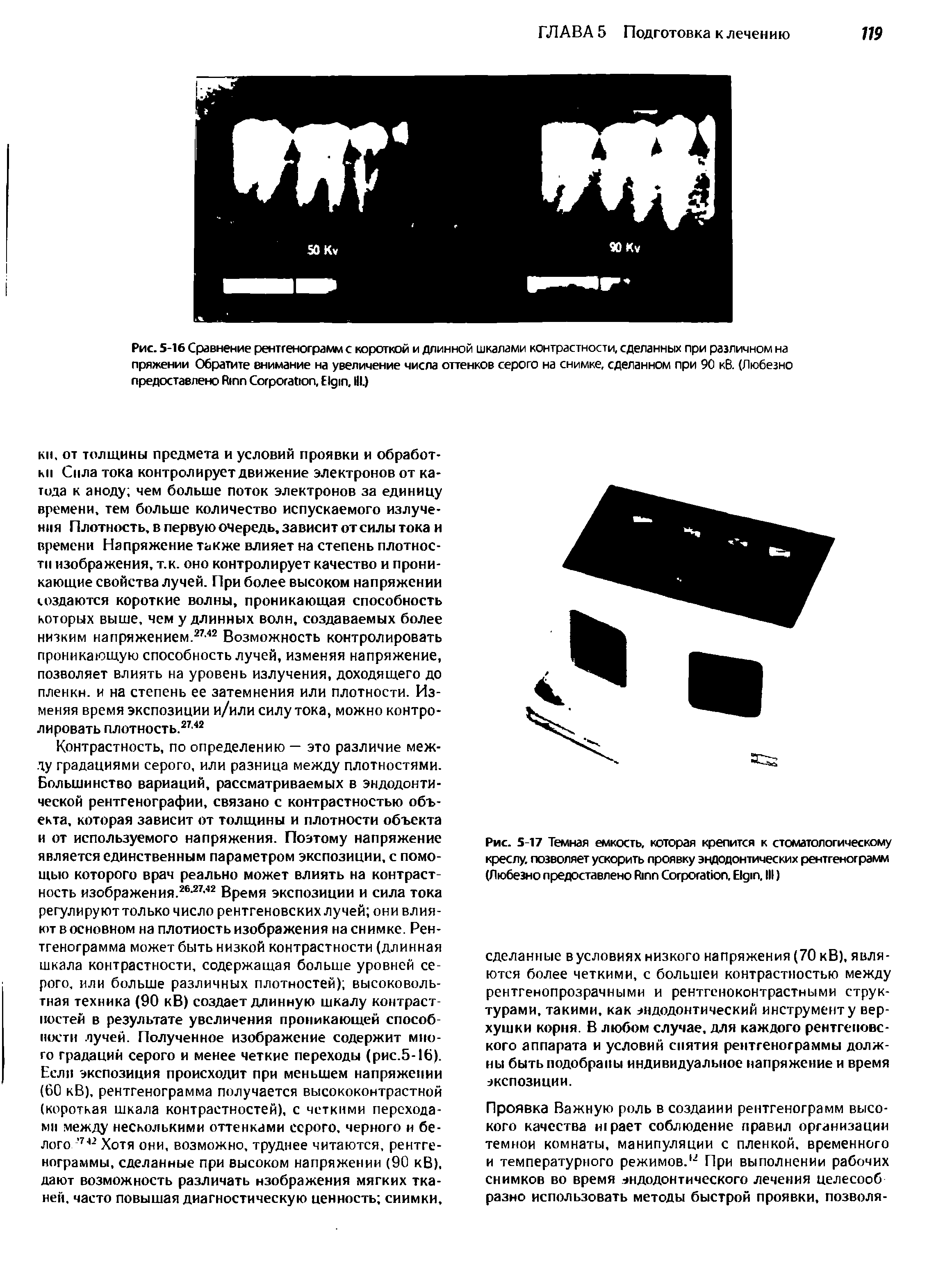 Рис. 5-16 Сравнение рентгенограмм с короткой и длинной шкалами контрастности, сделанных при различном на пряжении Обратите внимание на увеличение числа оттенков серого на снимке, сделанном при 90 кВ. (Любезно предоставлено R C , E , III.)...
