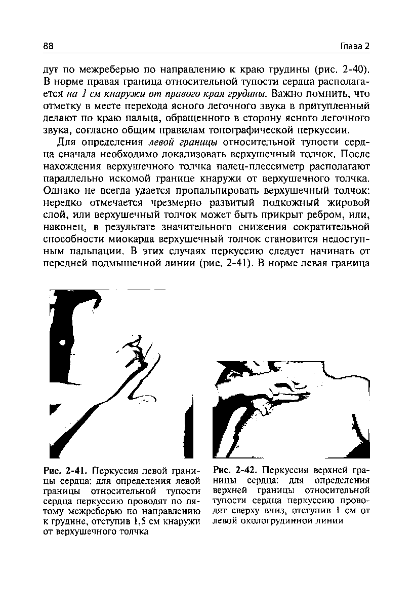 Рис. 2-42. Перкуссия верхней границы сердца для определения верхней границы относительной тупости сердца перкуссию проводят сверху вниз, отступив 1 см от левой окологрудинной линии...