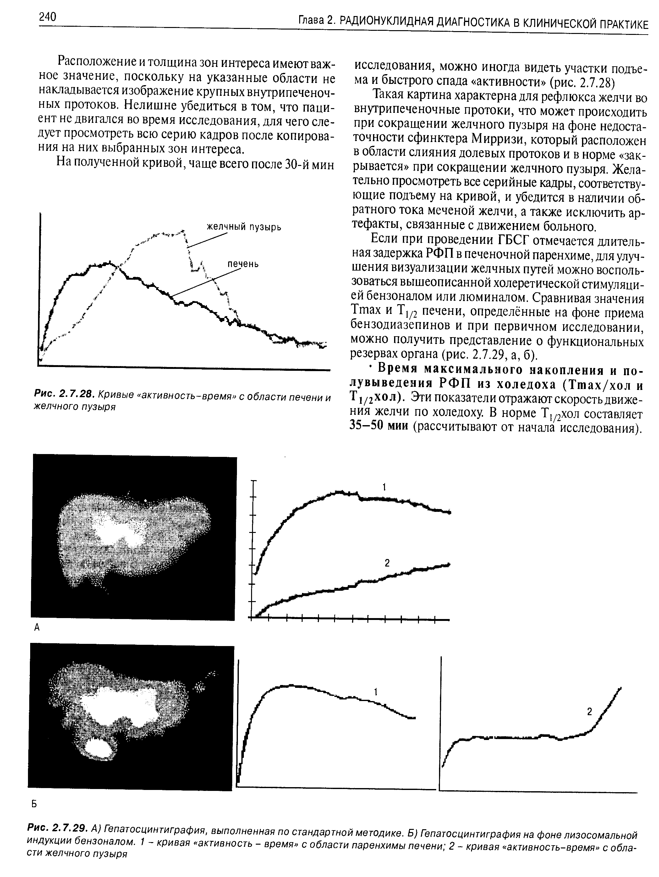 Рис. 2.7.29. А) Гепатосцинтиграфия, выполненная по стандартной методике. Б) Гепатосцинтиграфия на фоне лизосомальной индукции бензоналом. 1 - кривая активность - время с области паренхимы печени 2 - кривая активность-время с области желчного пузыря...