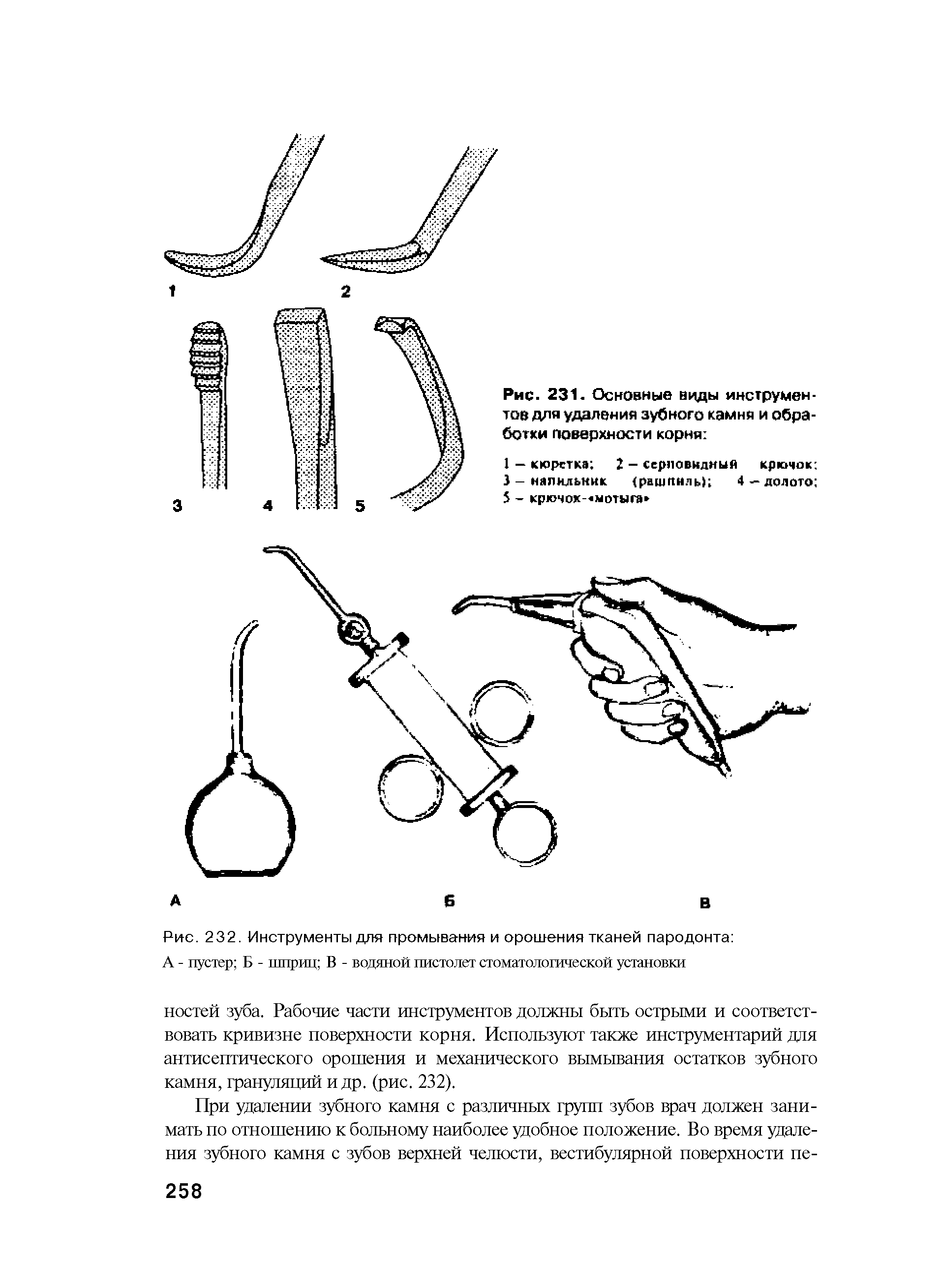 Рис. 231. Основные виды инструментов для удаления зубного камня и обработки Поверхности корня ...