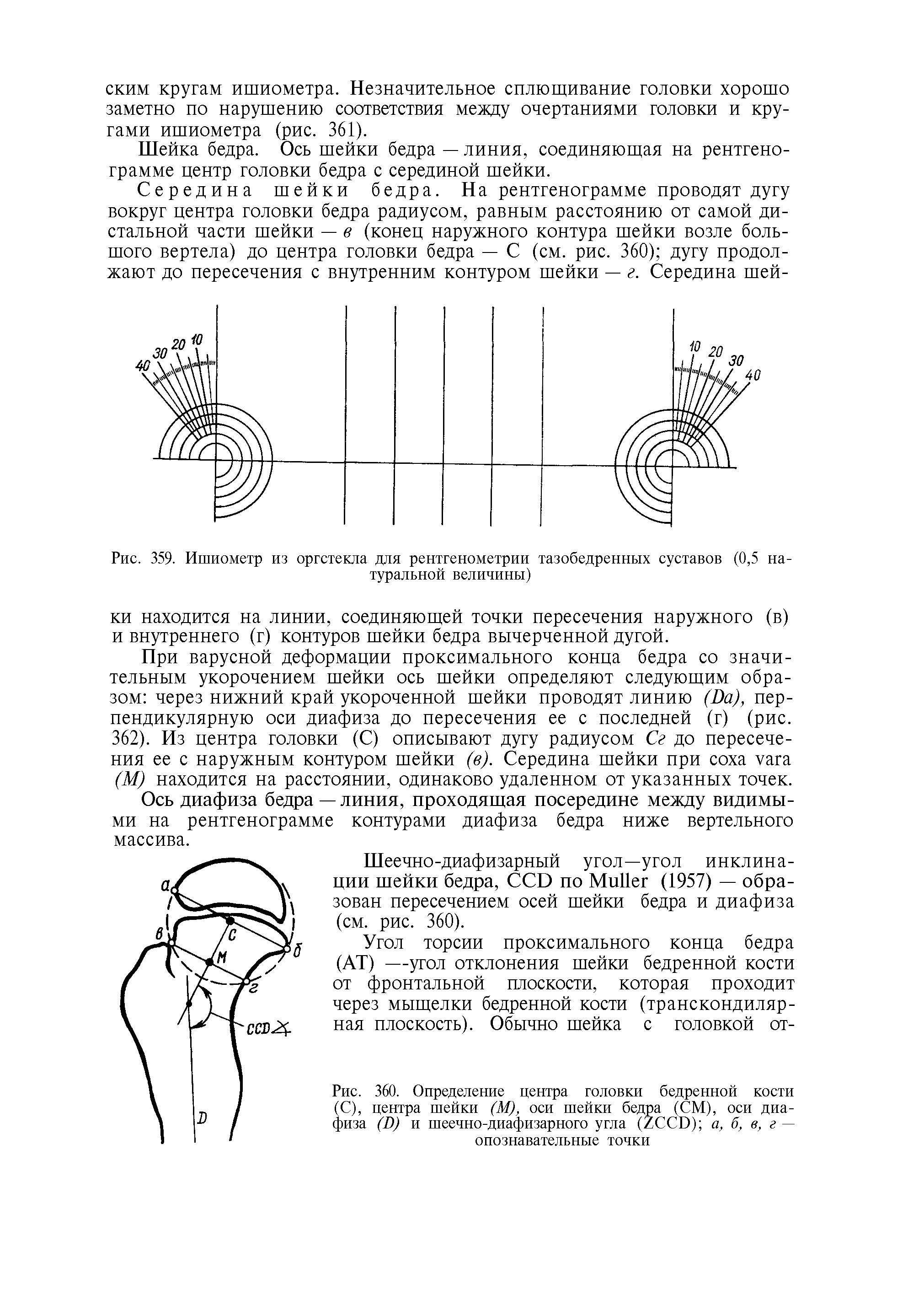 Рис. 360. Определение центра головки бедренной кости (С), центра шейки (М), оси шейки бедра (СМ), оси диафиза (Б) и шеечно-диафизарного угла (/( ( I )) а, б, в, г — опознавательные точки...