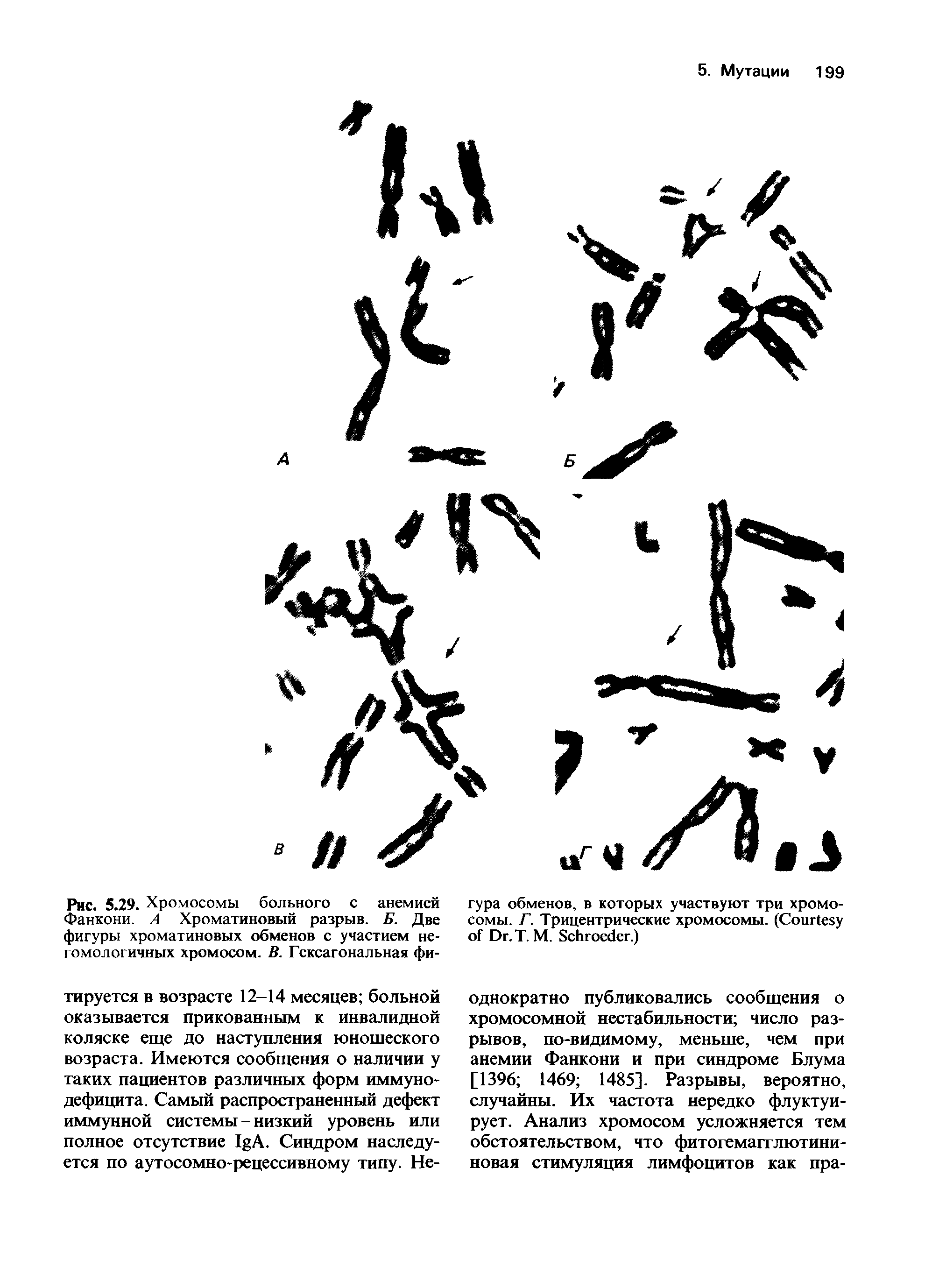 Рис. 5.29. Хромосомы больного с анемией Фанкони. А Хроматиновый разрыв. Б. Две фигуры хроматиновых обменов с участием негомологичных хромосом. В. Гексагональная фи-...