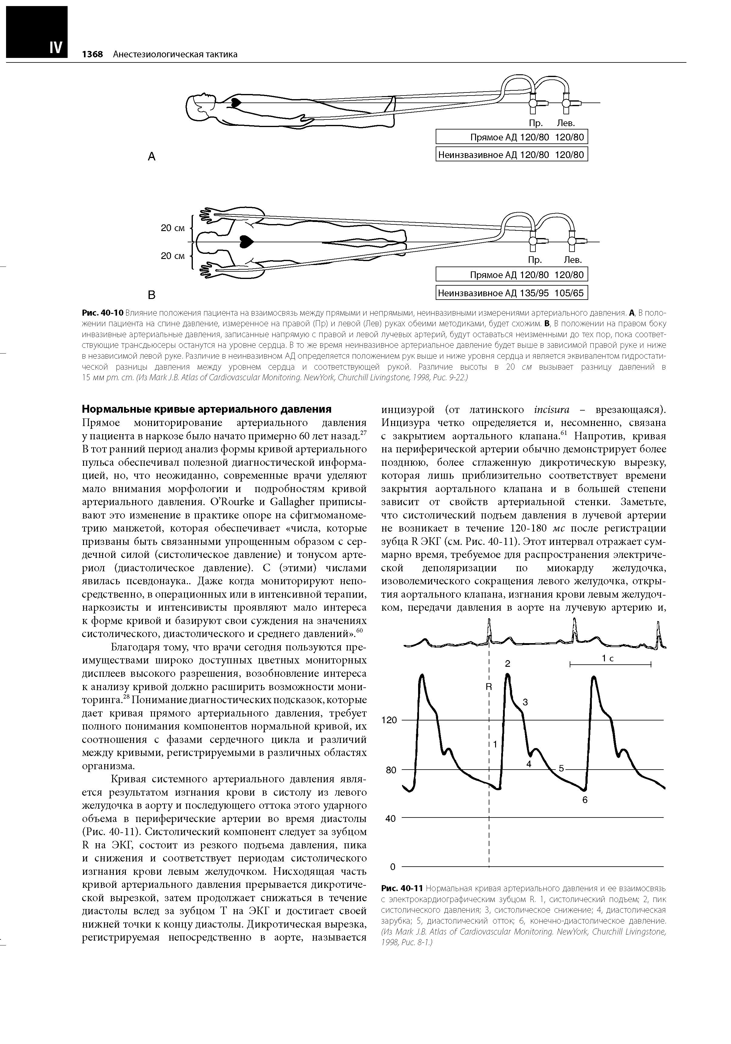 Рис. 40-11 Нормальная кривая артериального давления и ее взаимосвязь с электрокардиографическим зубцом R. 1, систолический подъем 2, пик систолического давления 3, систолическое снижение 4, диастолическая зарубка 5, диастолический отток 6, конечно-диастолическое давление. (Из M J.B. A C M . N Y , C L , 1998, P . 8-1.)...