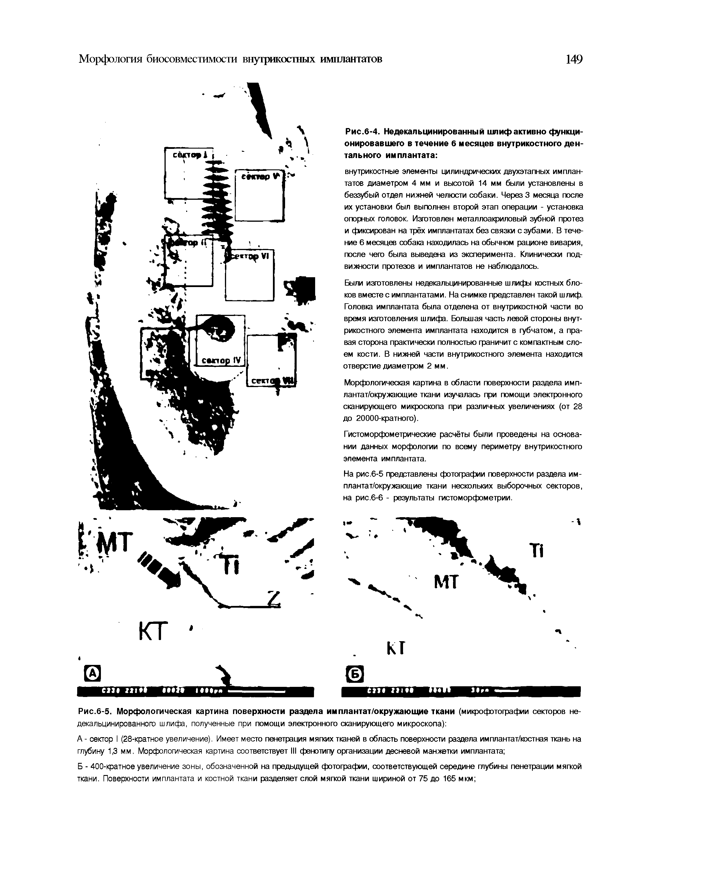 Рис.6-5. Морфологическая картина поверхности раздела им плантат/окружающие ткани (микрофотографии секторов не-декальцинированного шлифа, полученные при помощи электронного сканирующего микроскопа) ...