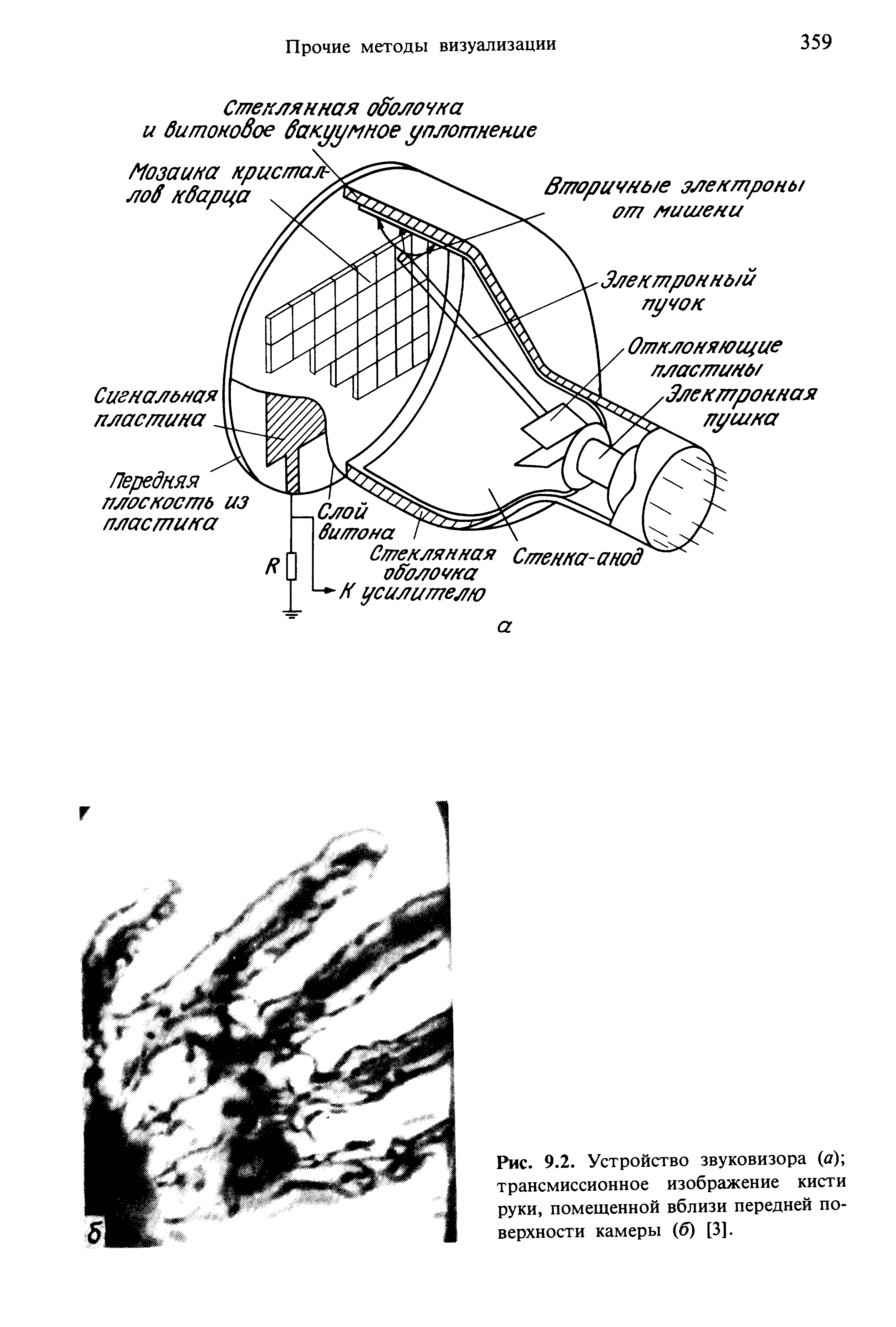 Рис. 9.2. Устройство звуковизора (д) трансмиссионное изображение кисти руки, помещенной вблизи передней поверхности камеры (6) [3].