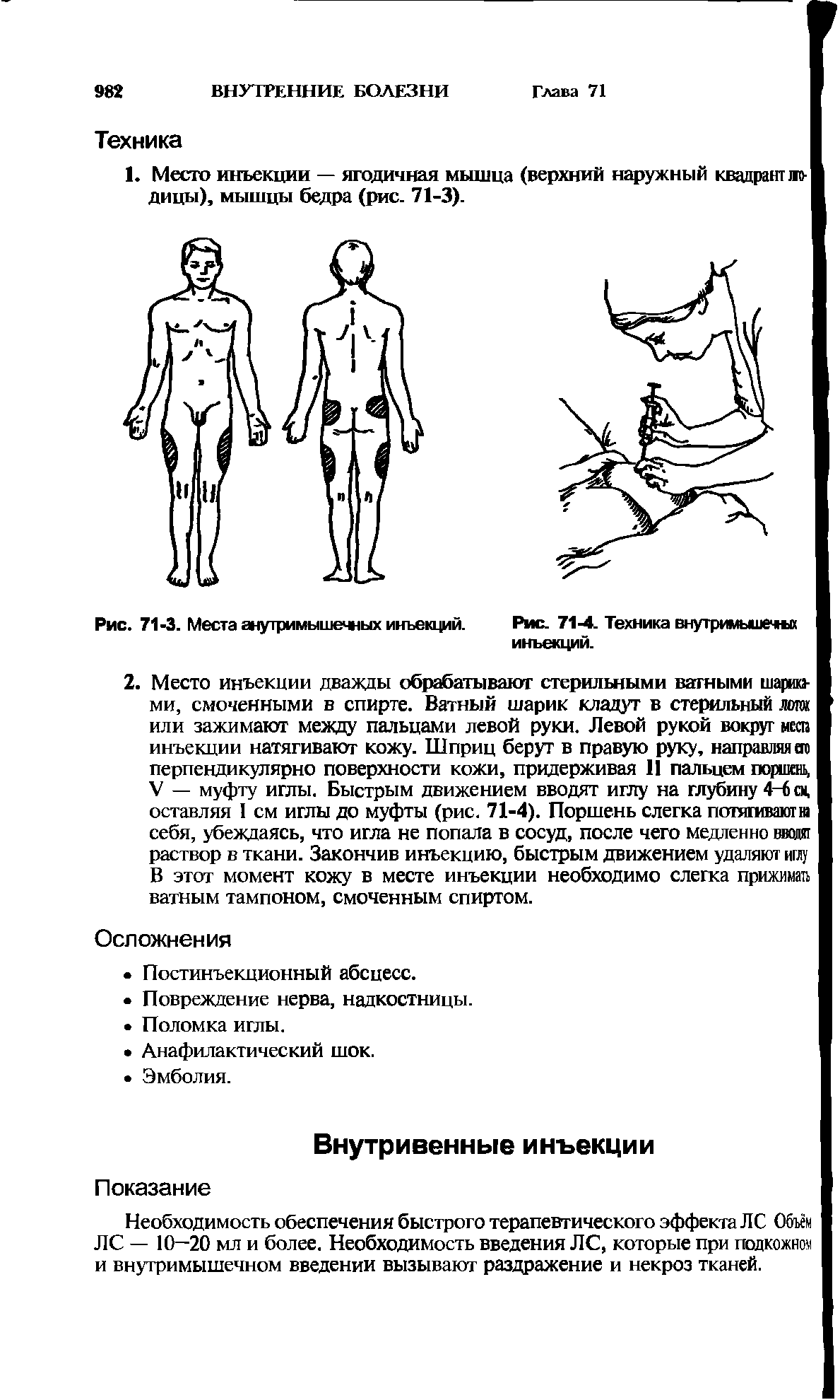 Рис. 71-3. Места внутримышечных инъекций. Рис. 71-4. Техника внутримышечпа инъекций.