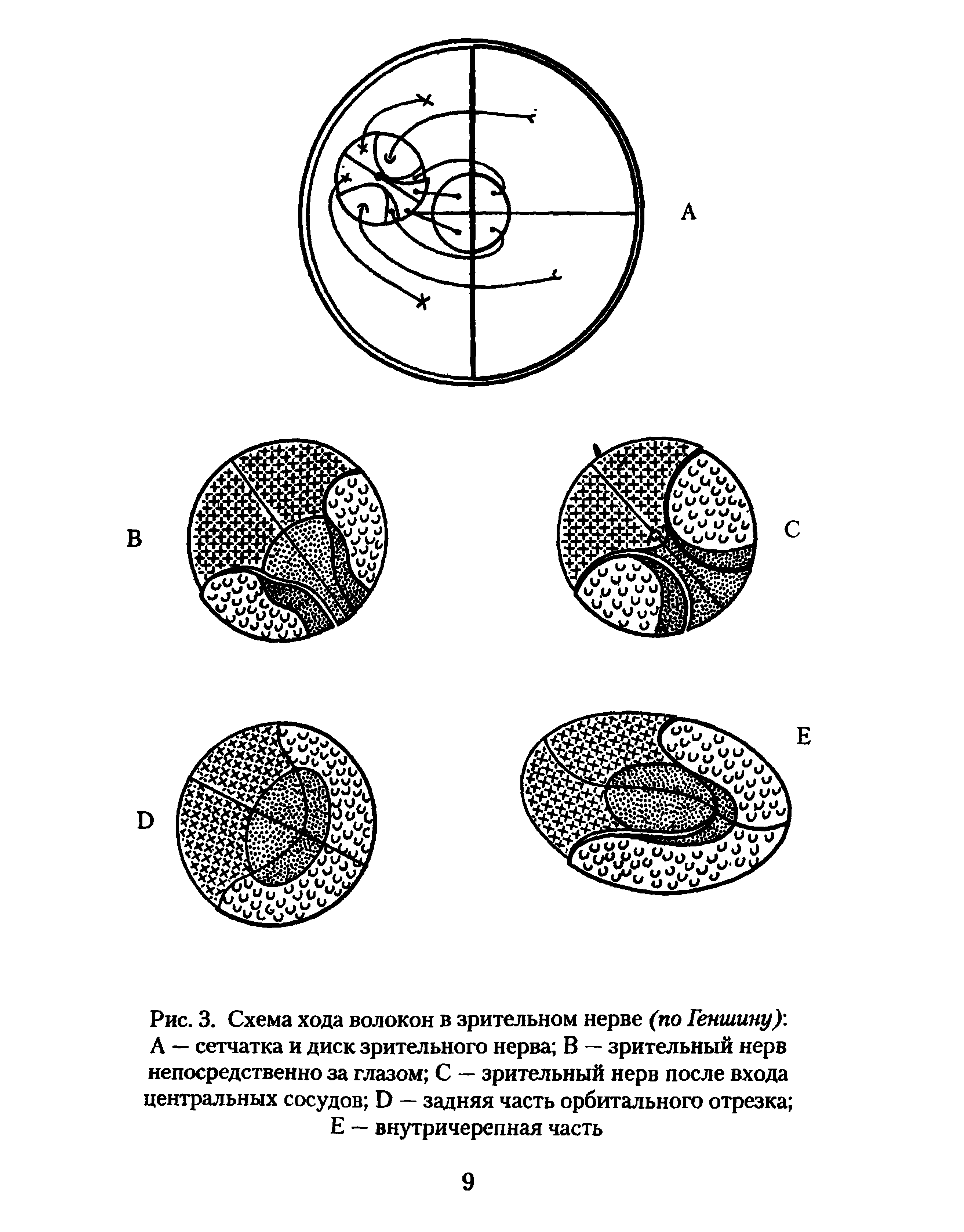 Рис. 3. Схема хода волокон в зрительном нерве (по Генгиину) А — сетчатка и диск зрительного нерва В — зрительный нерв непосредственно за глазом С — зрительный нерв после входа центральных сосудов Э — задняя часть орбитального отрезка Е — внутричерепная часть...